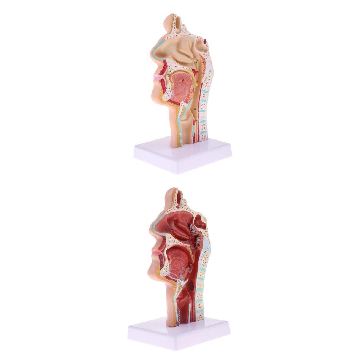2 Sets 1:1 Human Nasal Oral Cavity Throat Pathological & Normal Anaomy Model