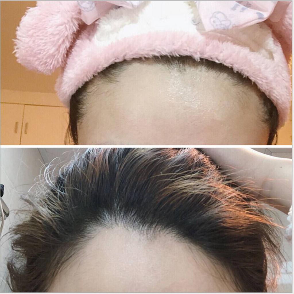 4x Hair Repair Thin Hairline Modified Powder Long Lasting Hair Shadow