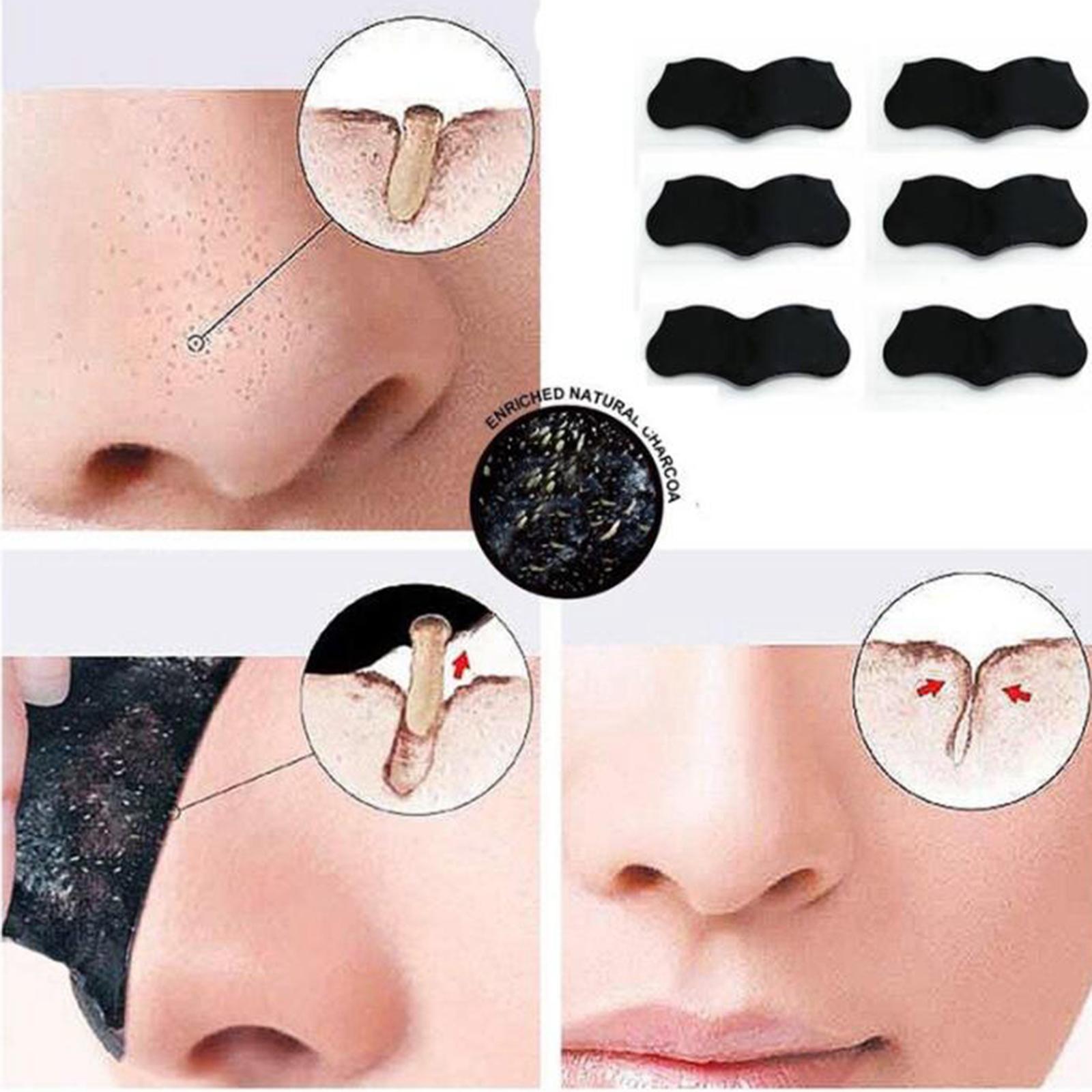 4xBlackhead Remover Peel Off Nose Strips Pore Cleaner Acne Treatments 10 Pcs