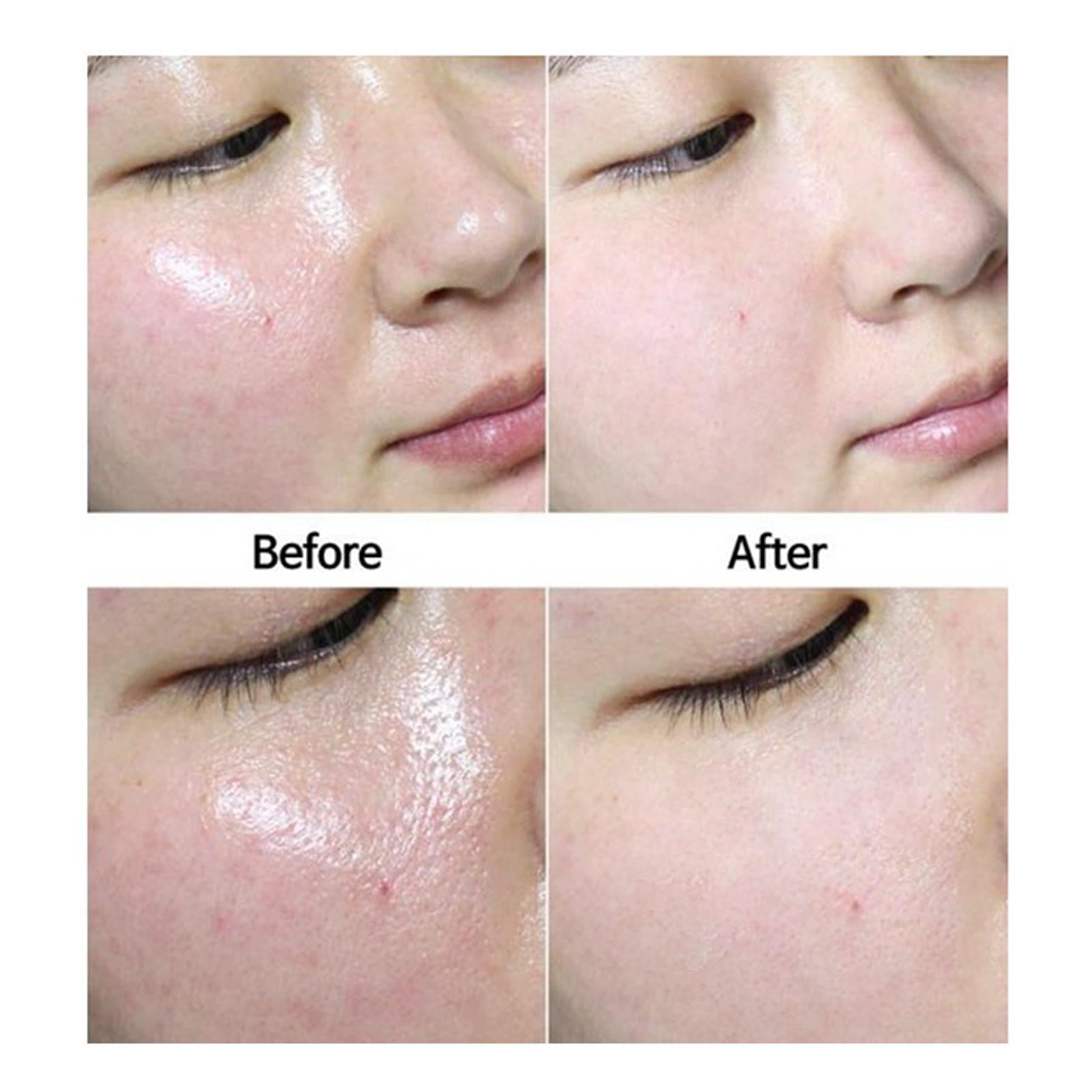 ABS Oil Absorbing Volcanic Face Roller Portable for Makeup Men Women White