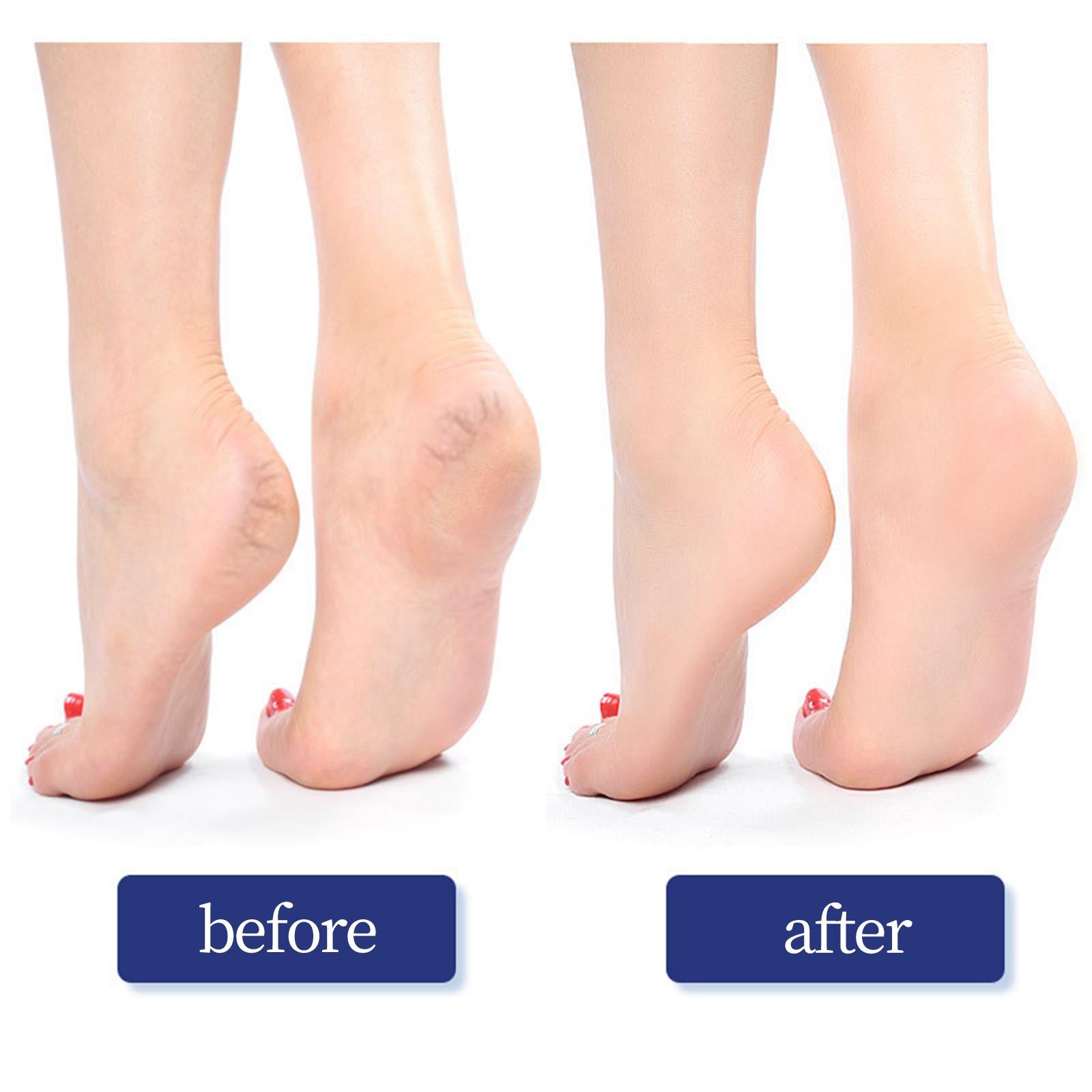 2xCuboid Foot Pumice Stones Double Sided for Dead Hard Skin Feet Care Blue S