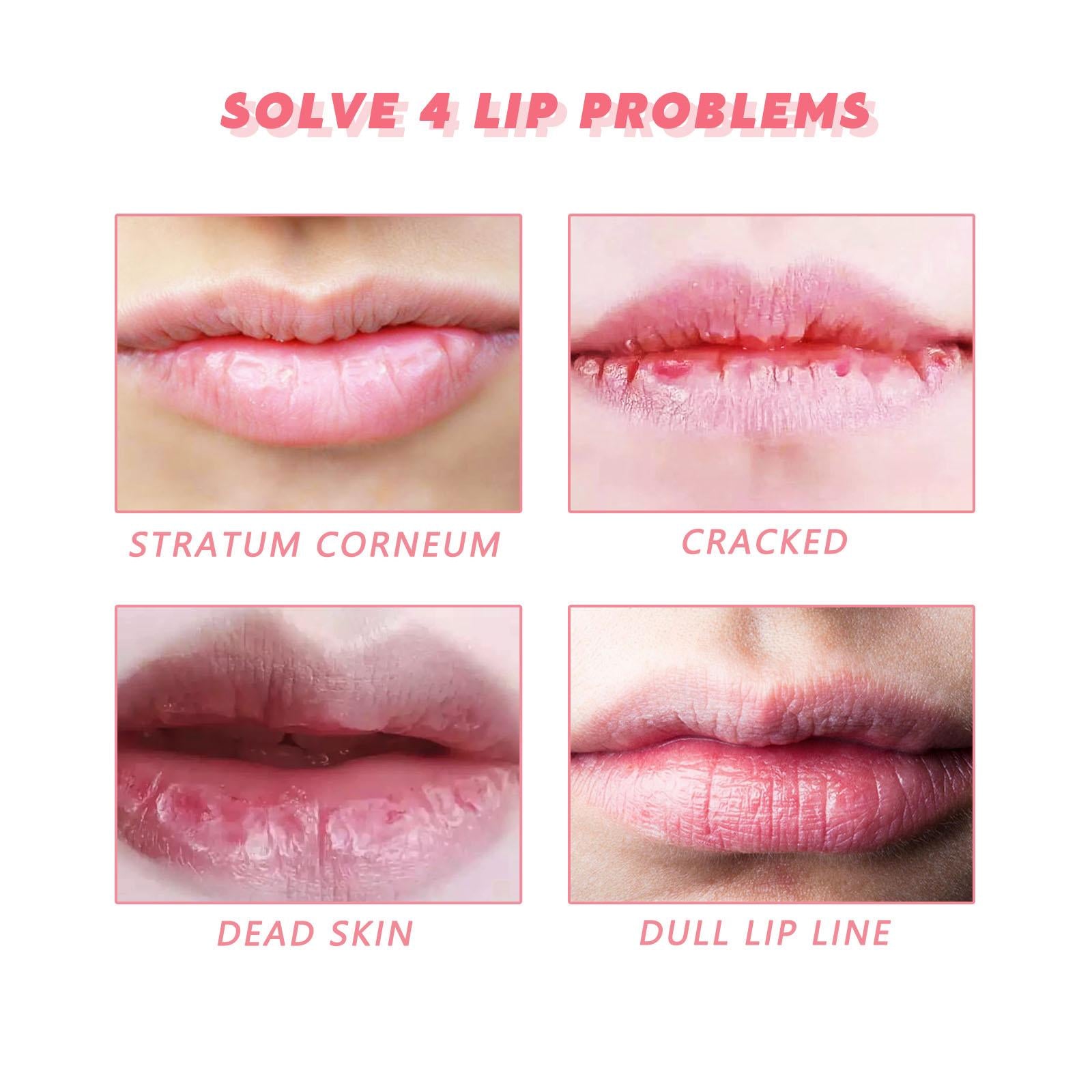 3xLip Scrub Exfoliator for Dull Lip Lines Keratinized Cuticles