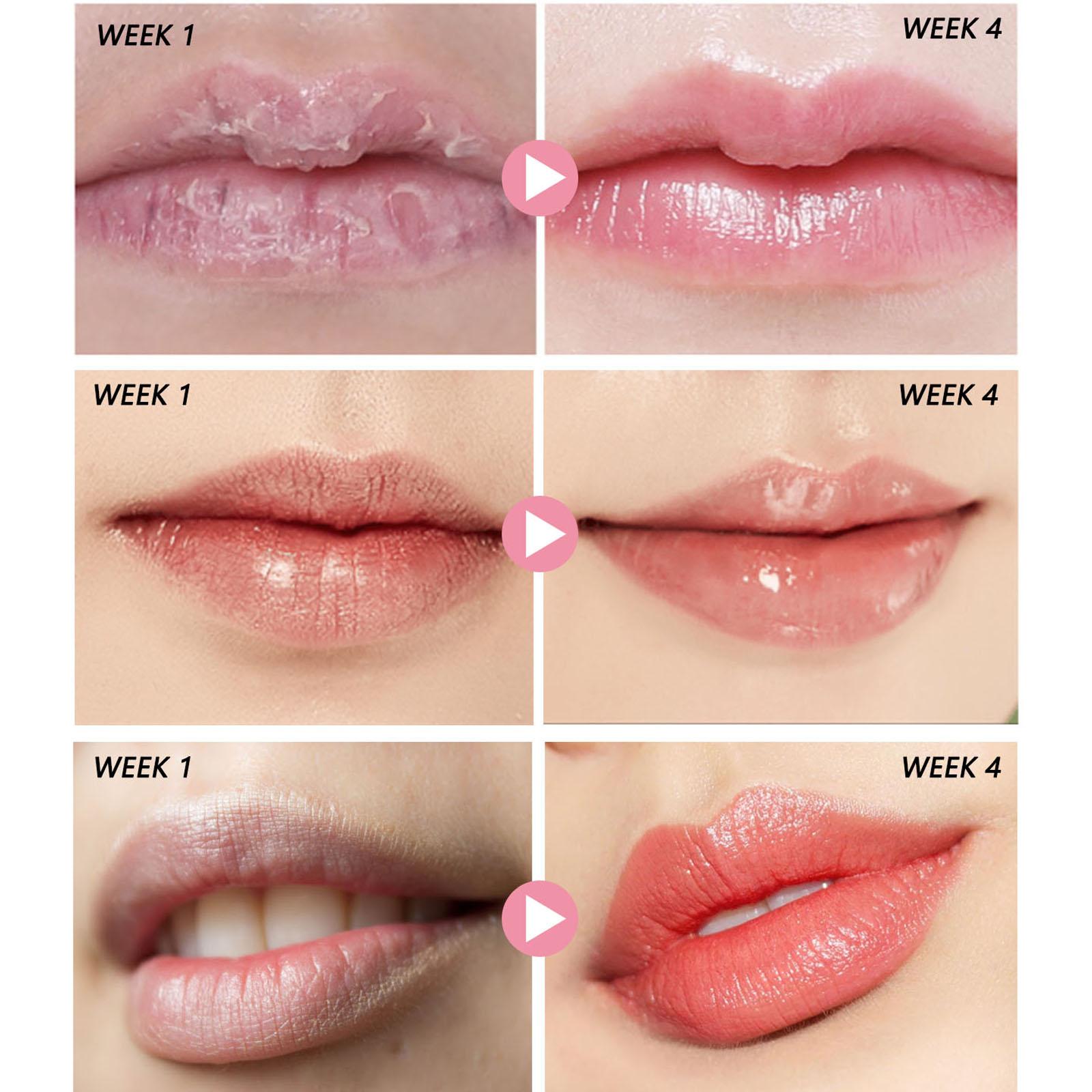 4xLip Scrub Exfoliator for Dull Lip Lines Keratinized Cuticles