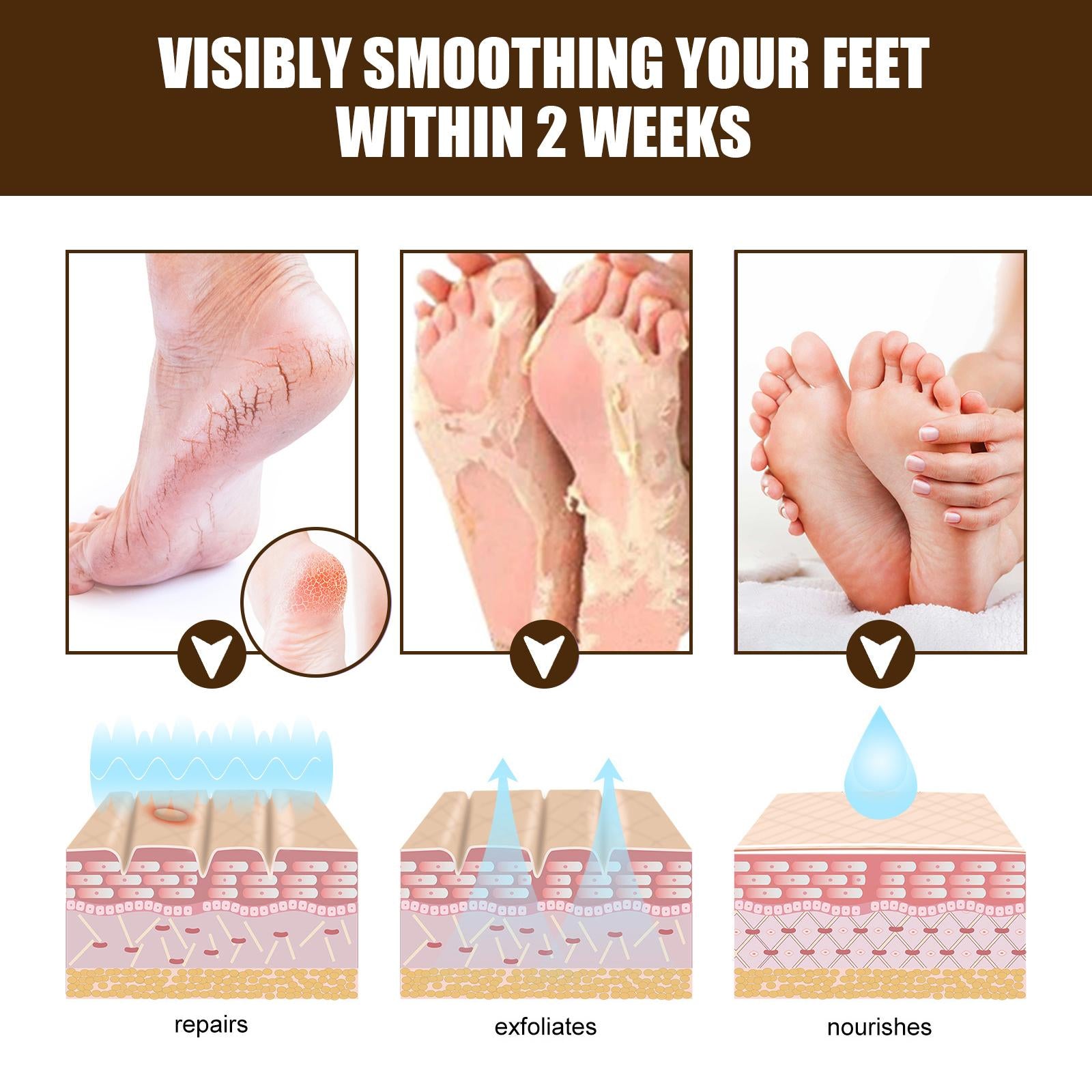 2xCracking Resistance Cream Moisturizing Cracking Feet Hands
