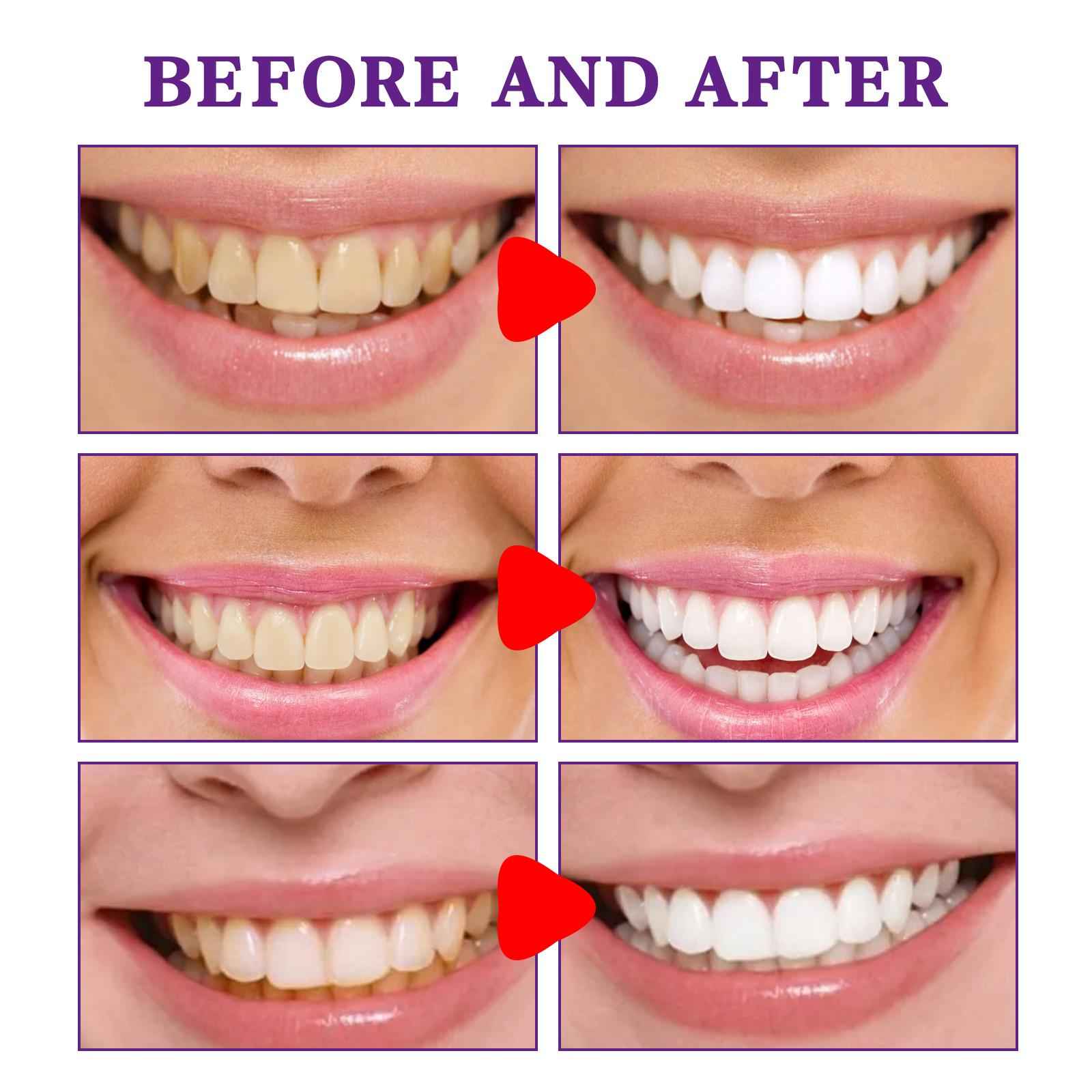 Purple Toothpaste for Sensitive Teeth 30ml Reduce Yellowing Brightening