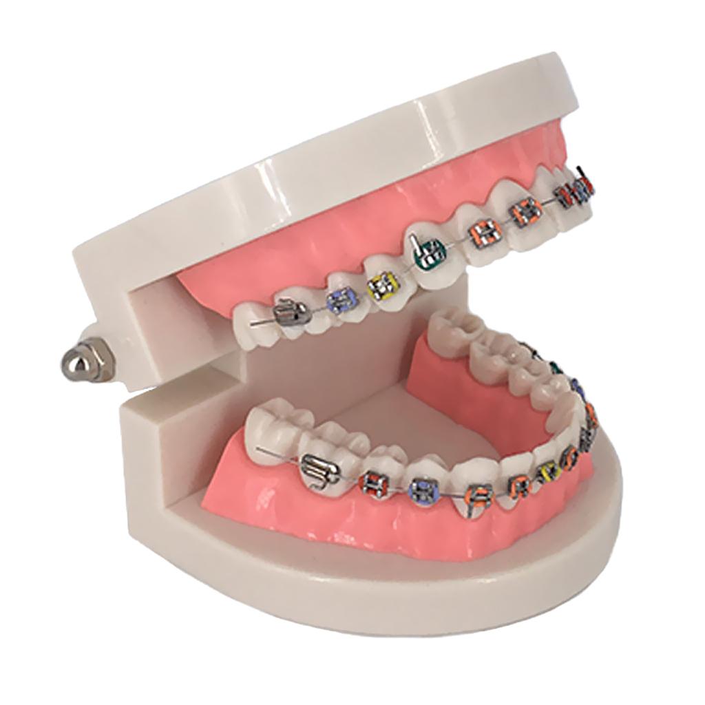 Orthodontic Dental Teaching Model Tooth Care Teaching Education Supplies