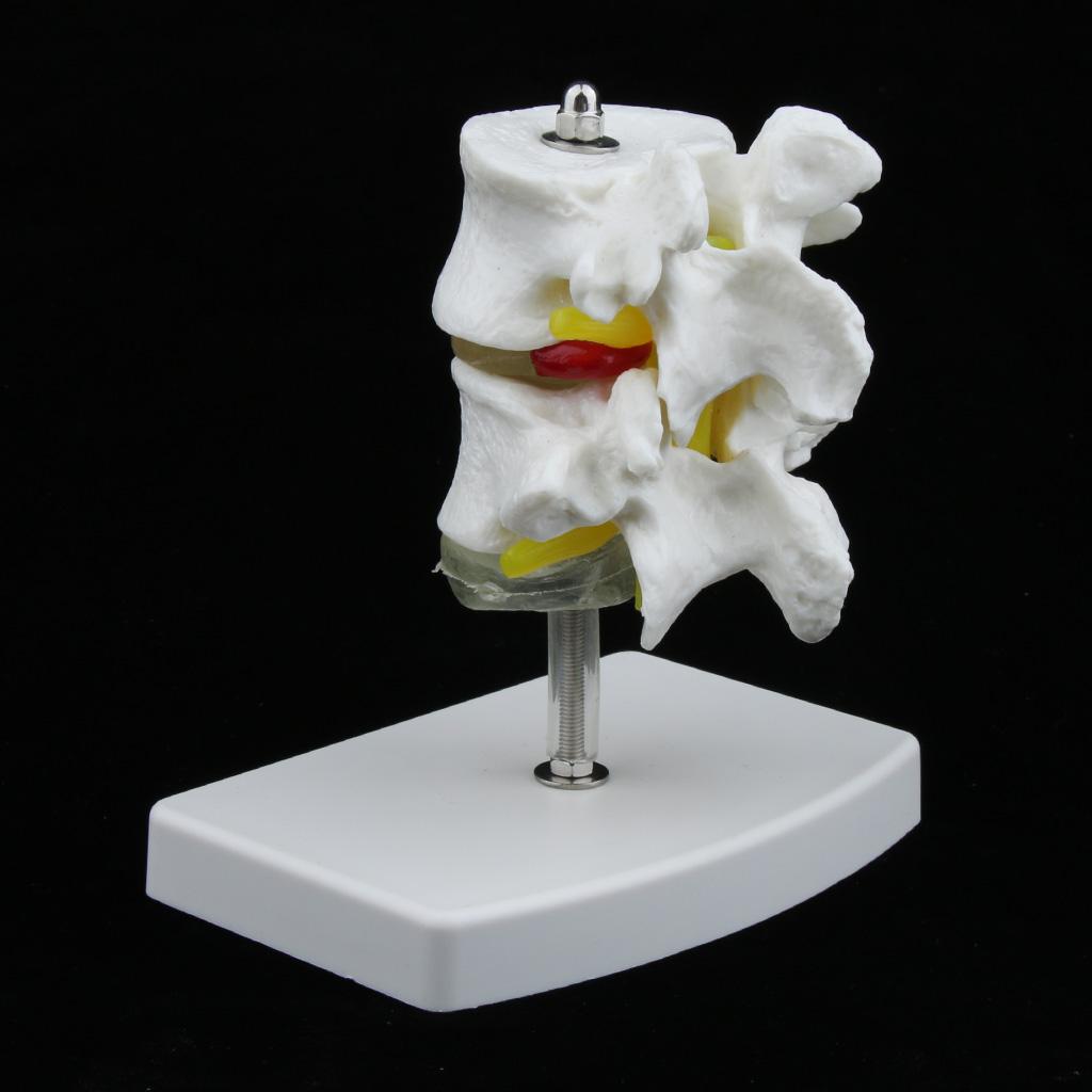 2-Section Life-Size Lumbar Vertebrae Model Teaching Tool with Base