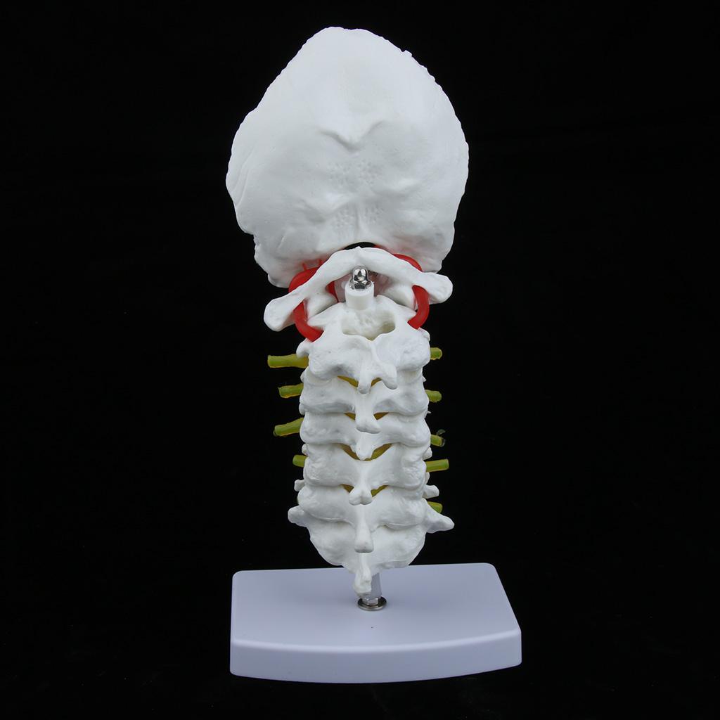 1:1 Human Cervical Vertebra Carotid Artery Flexible Model Study
