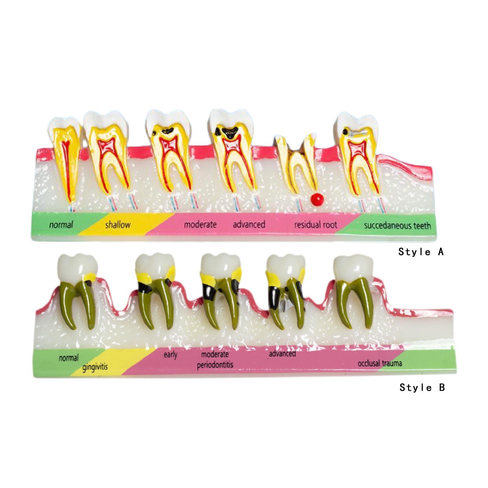 Demonstration Tooth Model Education Standard Tooth for School Classroom Kids Style A