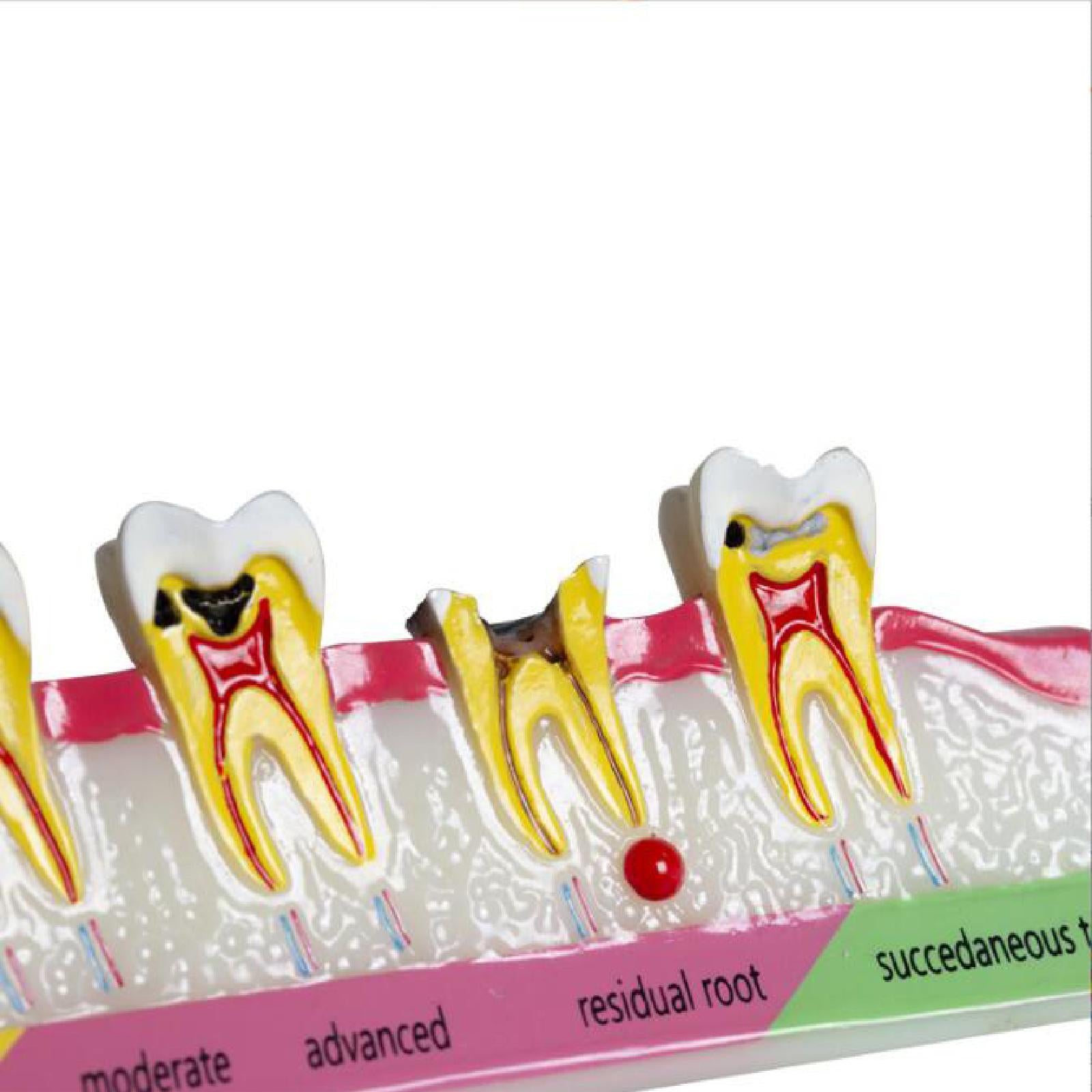 Demonstration Tooth Model Education Standard Tooth for School Classroom Kids Style A