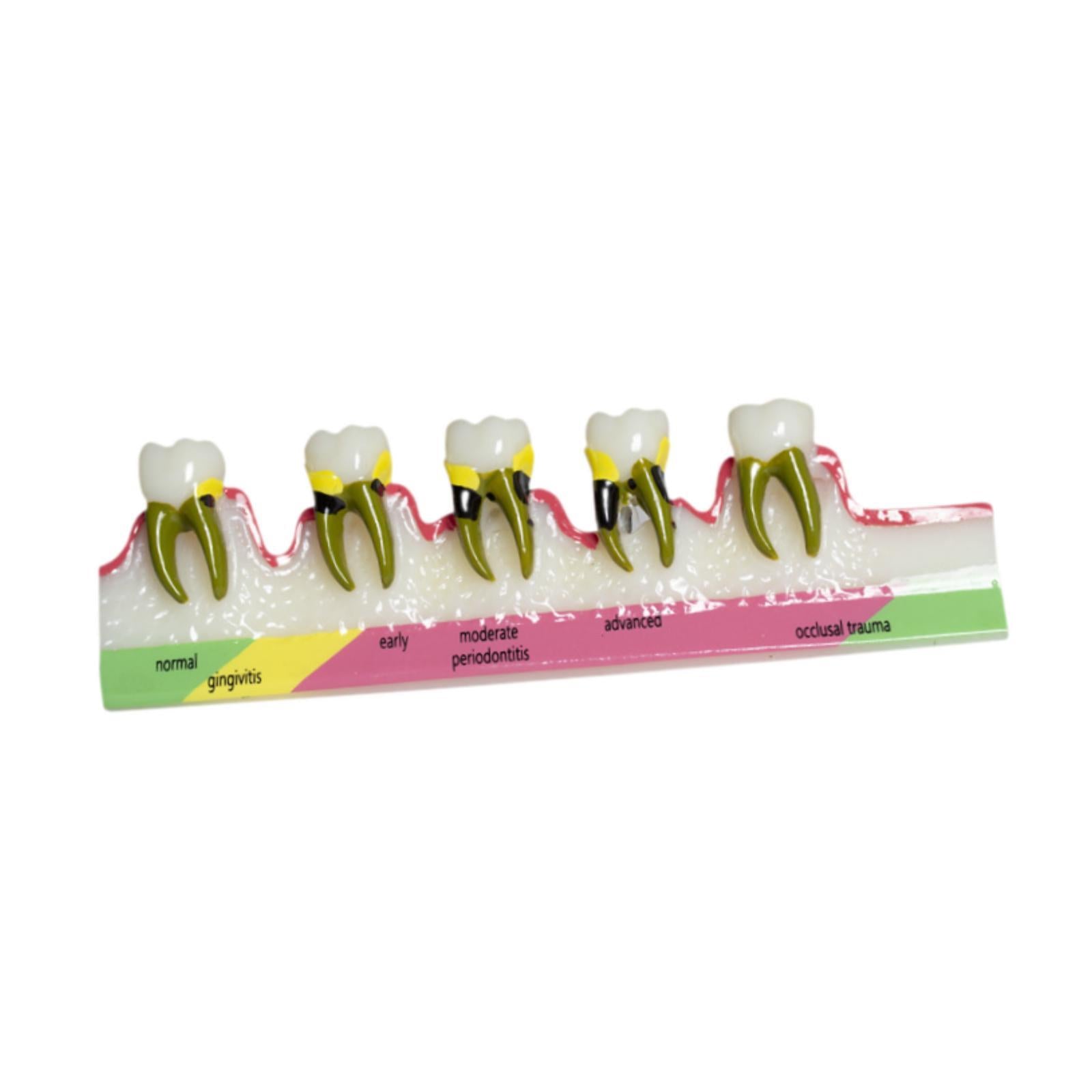 Demonstration Tooth Model Education Standard Tooth for School Classroom Kids Style B