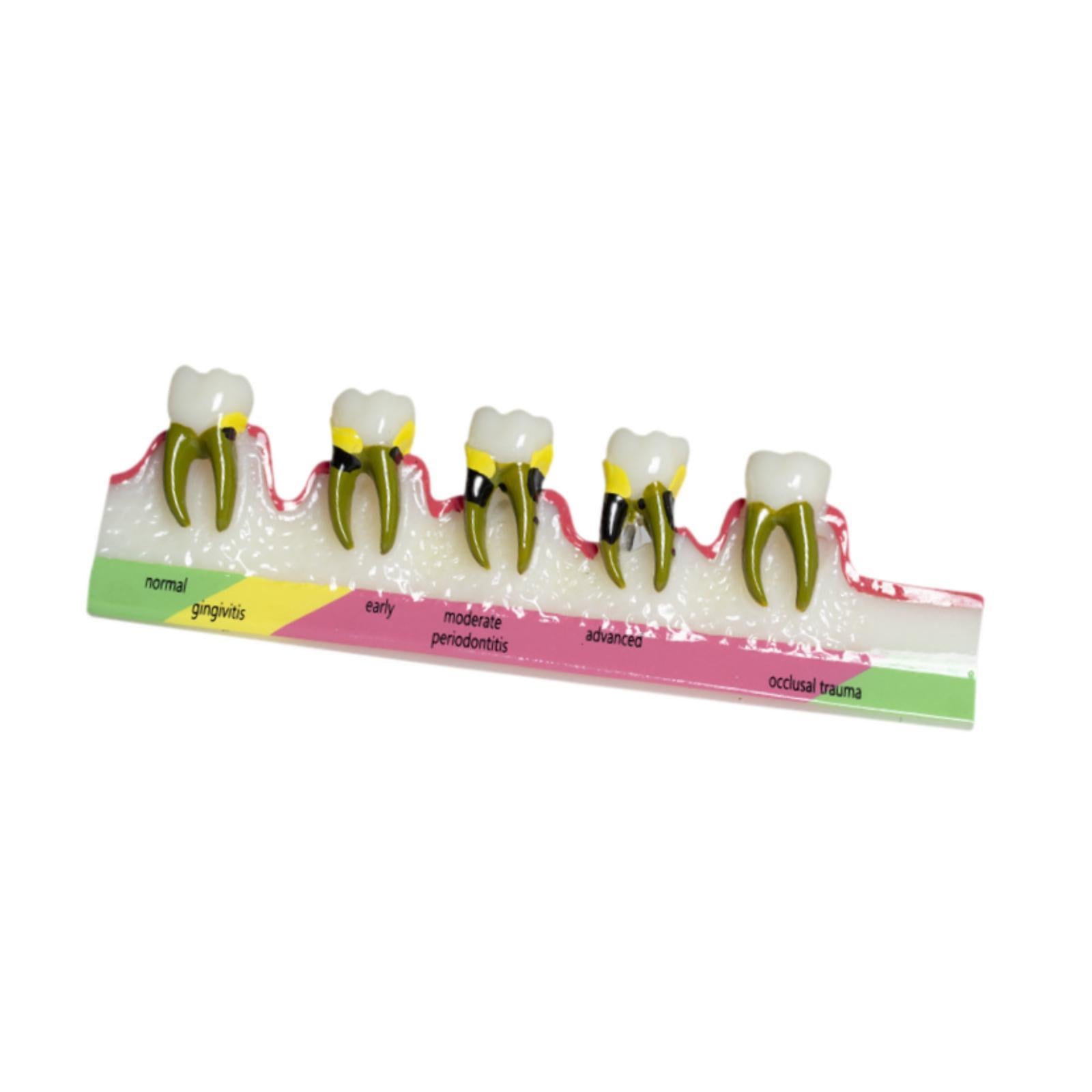 Demonstration Tooth Model Education Standard Tooth for School Classroom Kids Style B