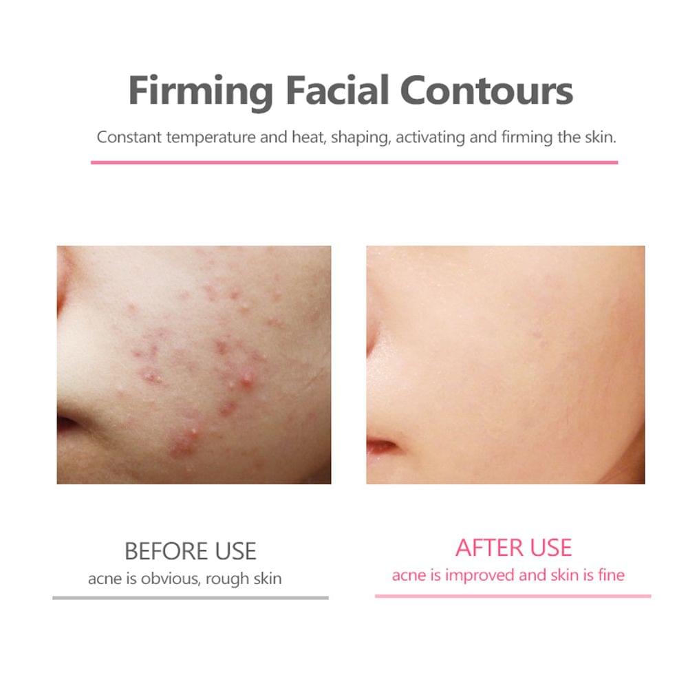 Household Red and Blue Light Cosmetic Instrument Warm