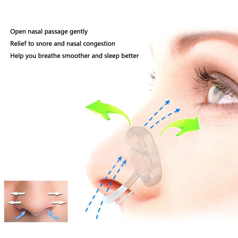 WoodyKnows Snoring Nasal Breathing Aid Nasal Dilators Reduce