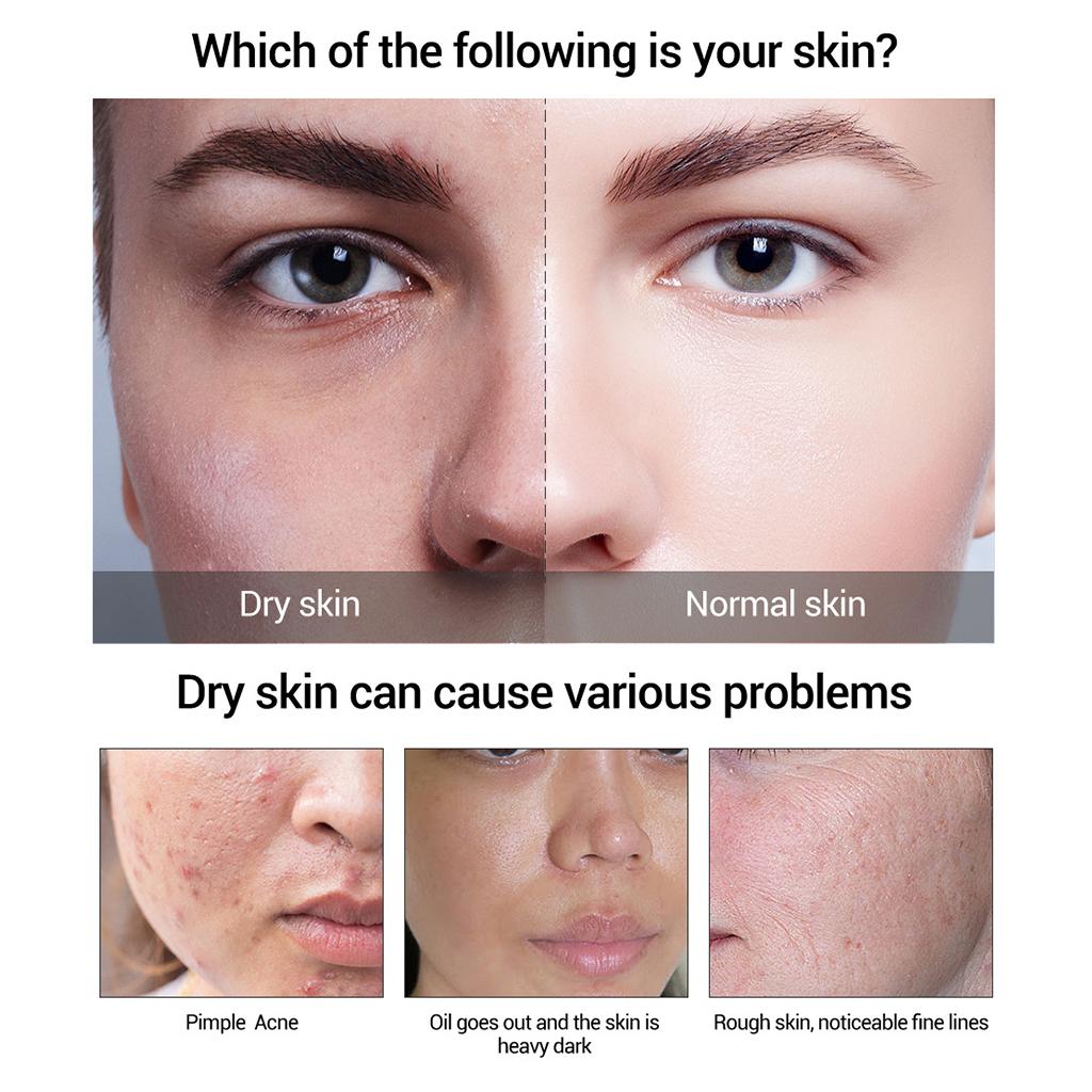 15ml Face Serum Essence Blackhead Removing Repairing Hyaluronic Acid