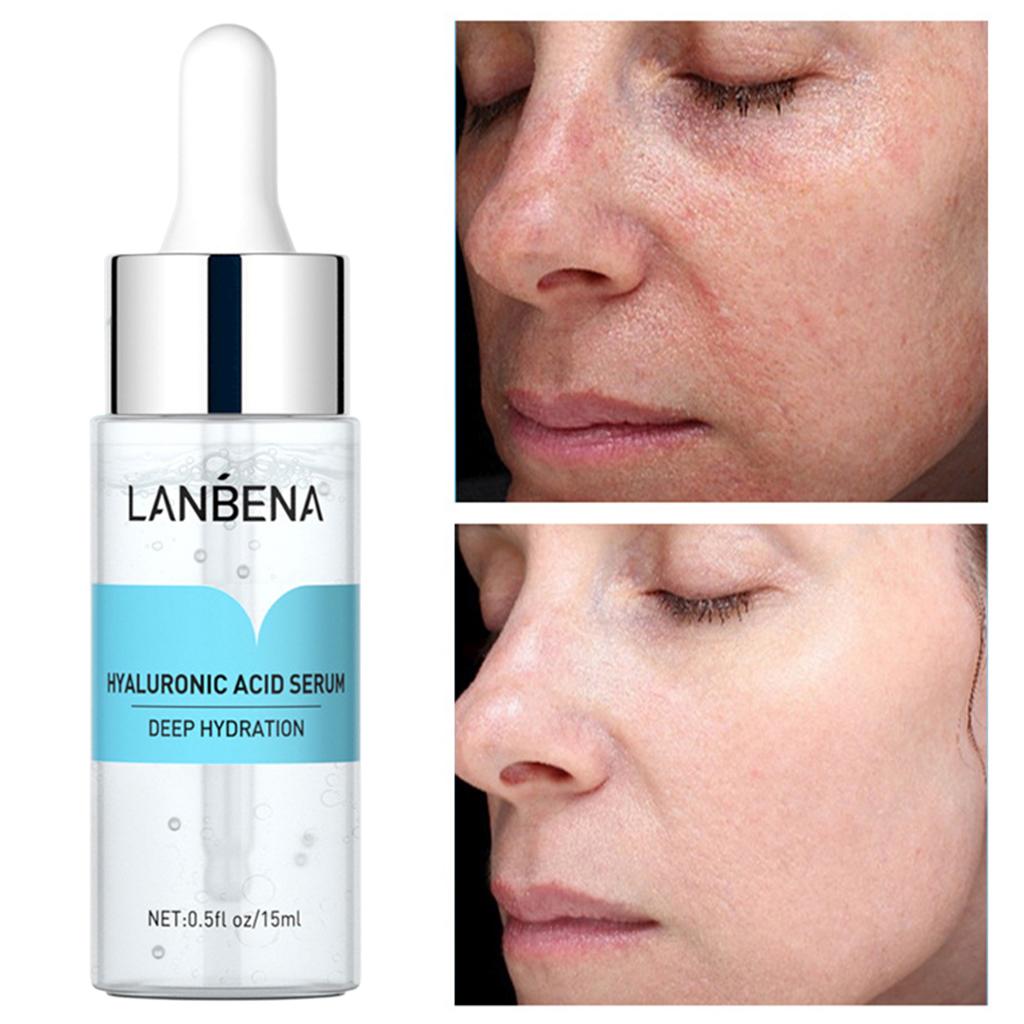 15ml Face Serum Essence Blackhead Removing Repairing Hyaluronic Acid