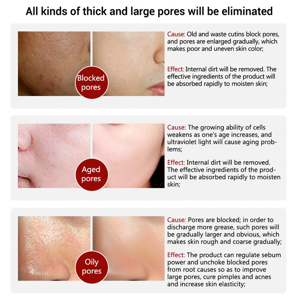 15ml Face Serum Essence Blackhead Removing Repairing Pore Treatment