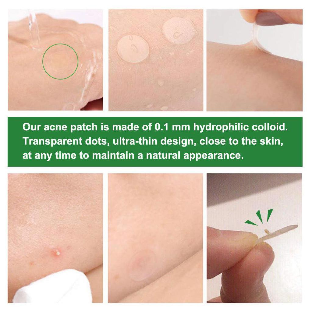 24pcs Acne Stickers Acne Patch Transparent Invisible Remover