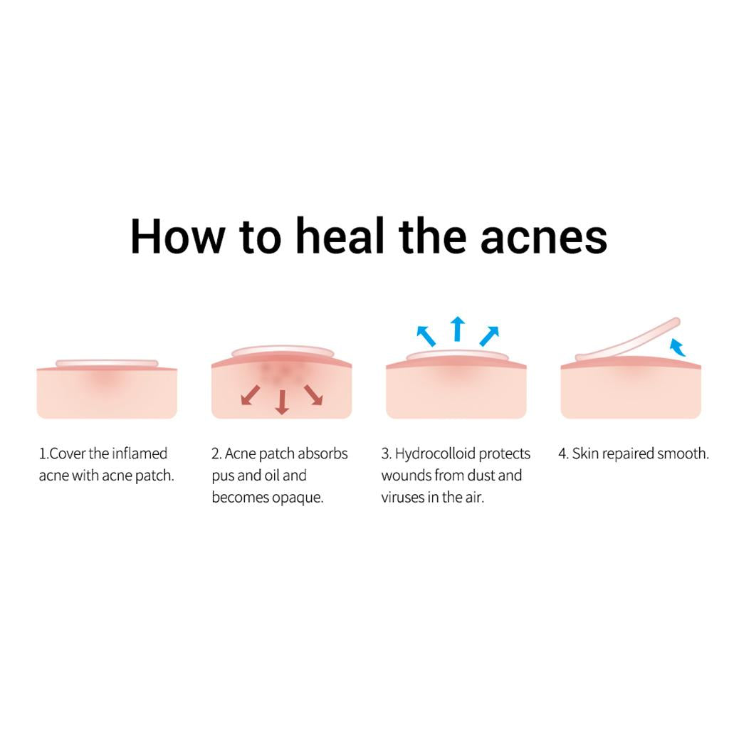 22pcs/sheet Breylee Tea Tree Acne Remover Patch Scar Treatment Stickers