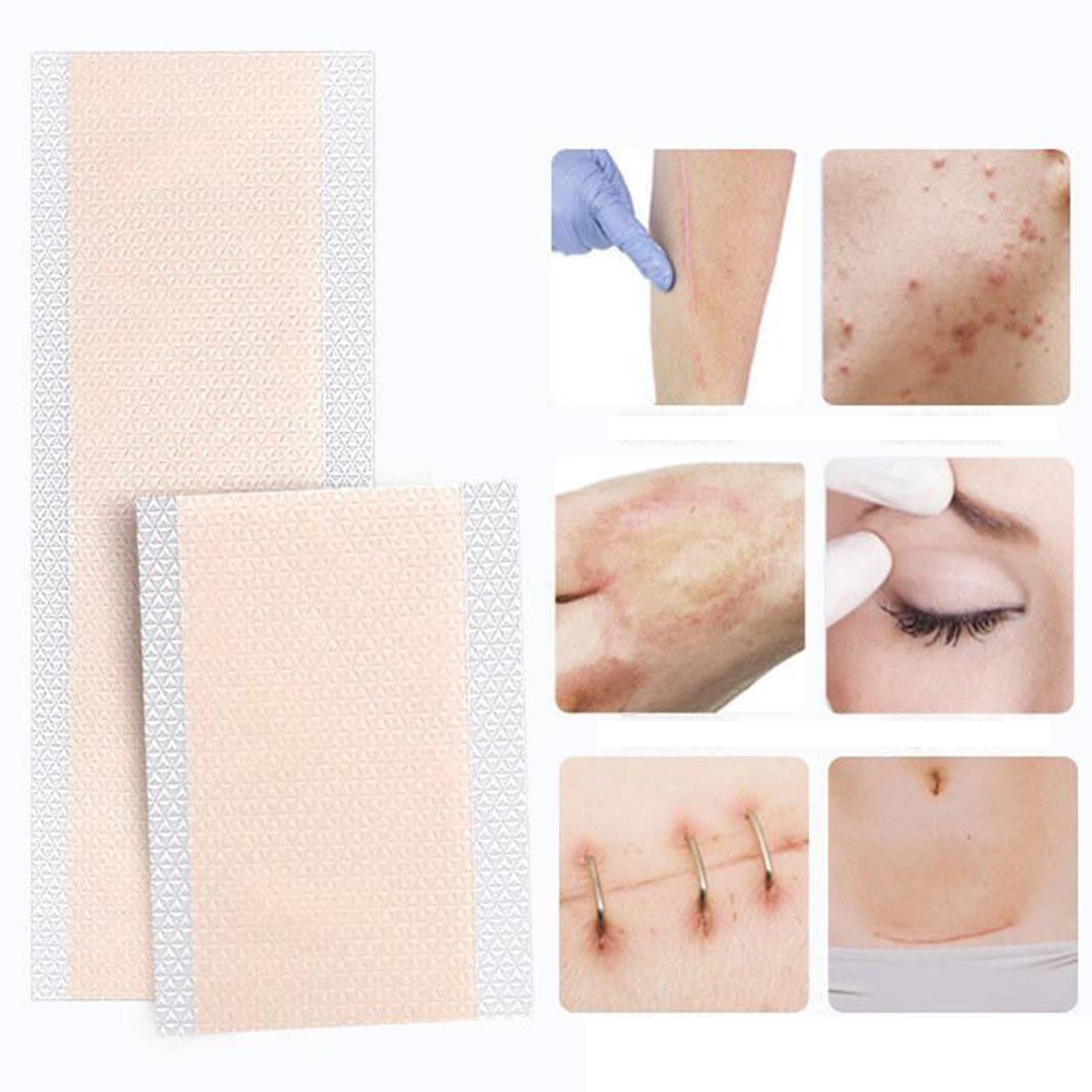 4 Pack Tattoo Flaw Concealer Tape Scar Acne Cover Flesh for Arms Neck Back S