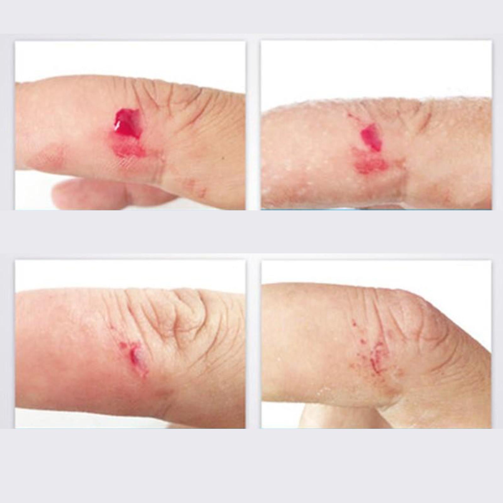 Waterproof 10ML Transparent Liquid Bandage Glue Gel Seal for Minor Cuts