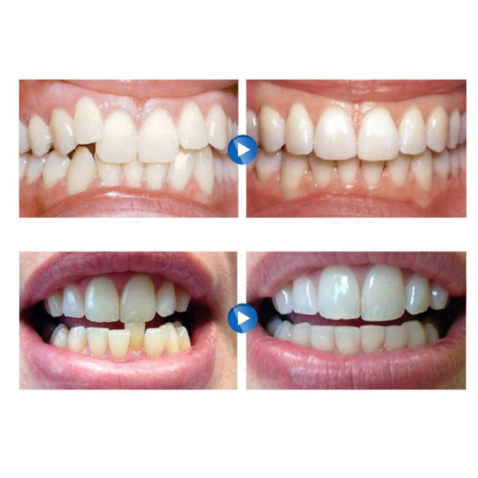 Dental Mouth Guard for Grinding Teeth Tooth Protector Night Guard Purple