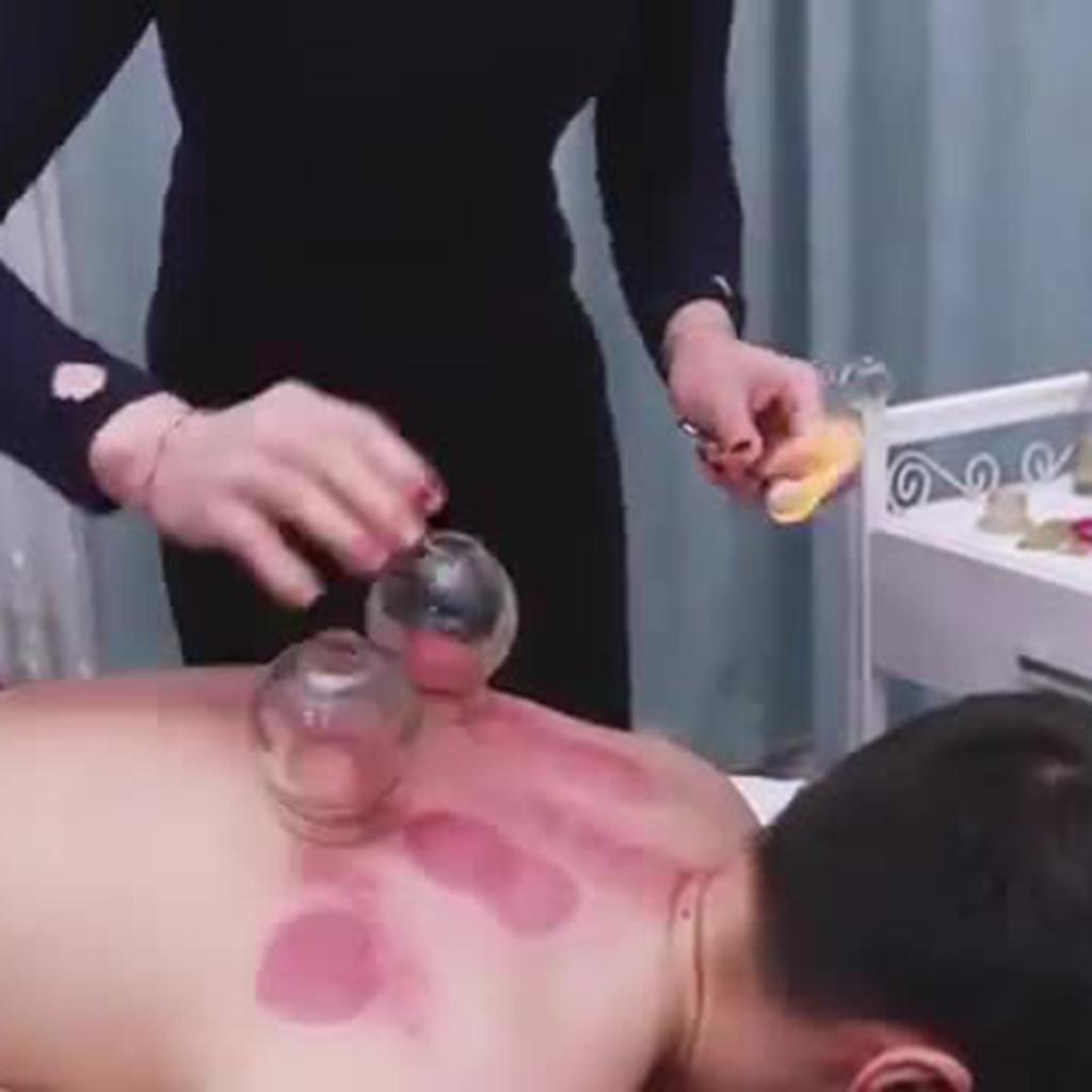 Professional 8pcs Glass Cupping Therapy Set Jars Glass Fire Cupping No.6