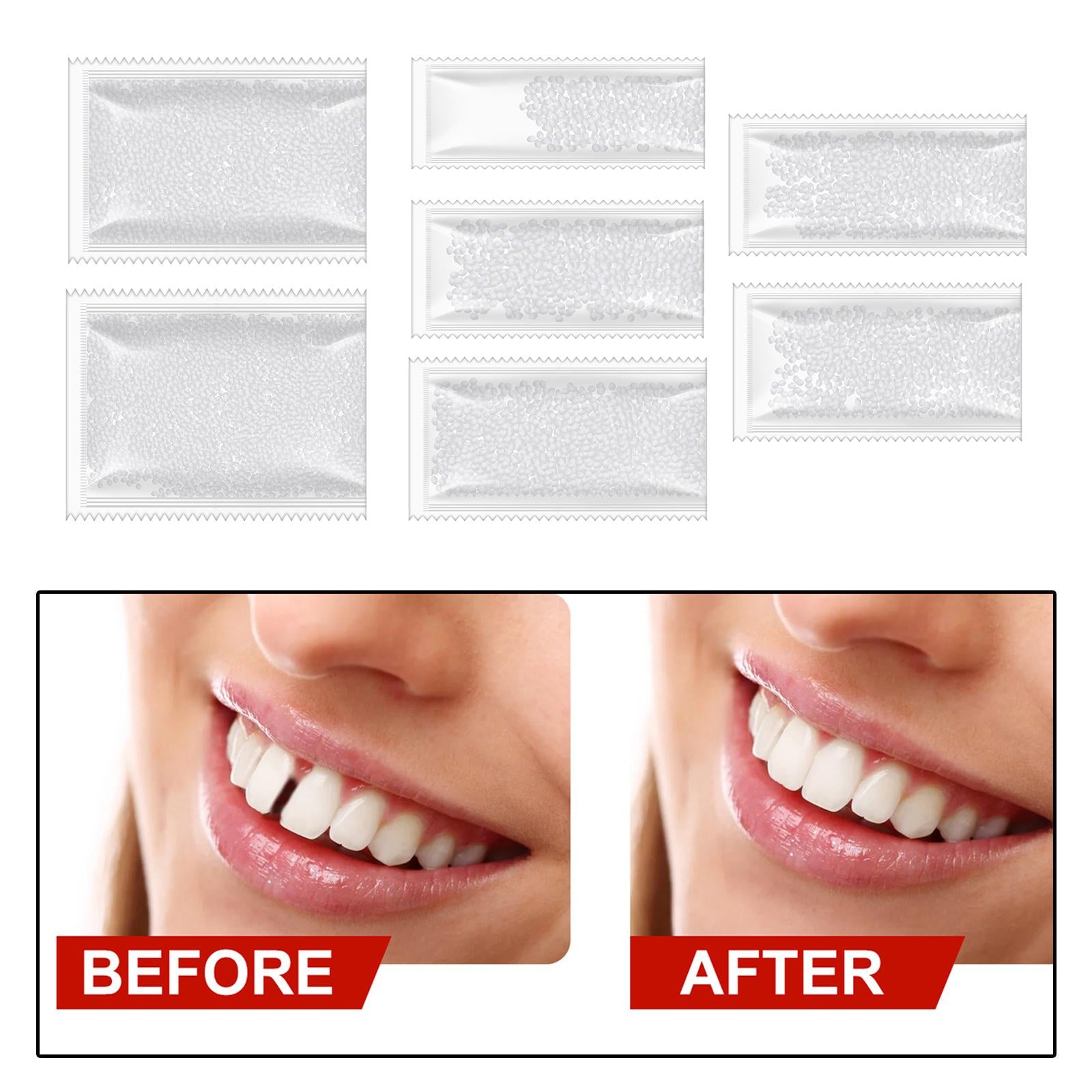 DIY Tooth Filling Thermal Beads Temporary Teeth Repair Moldable 5g