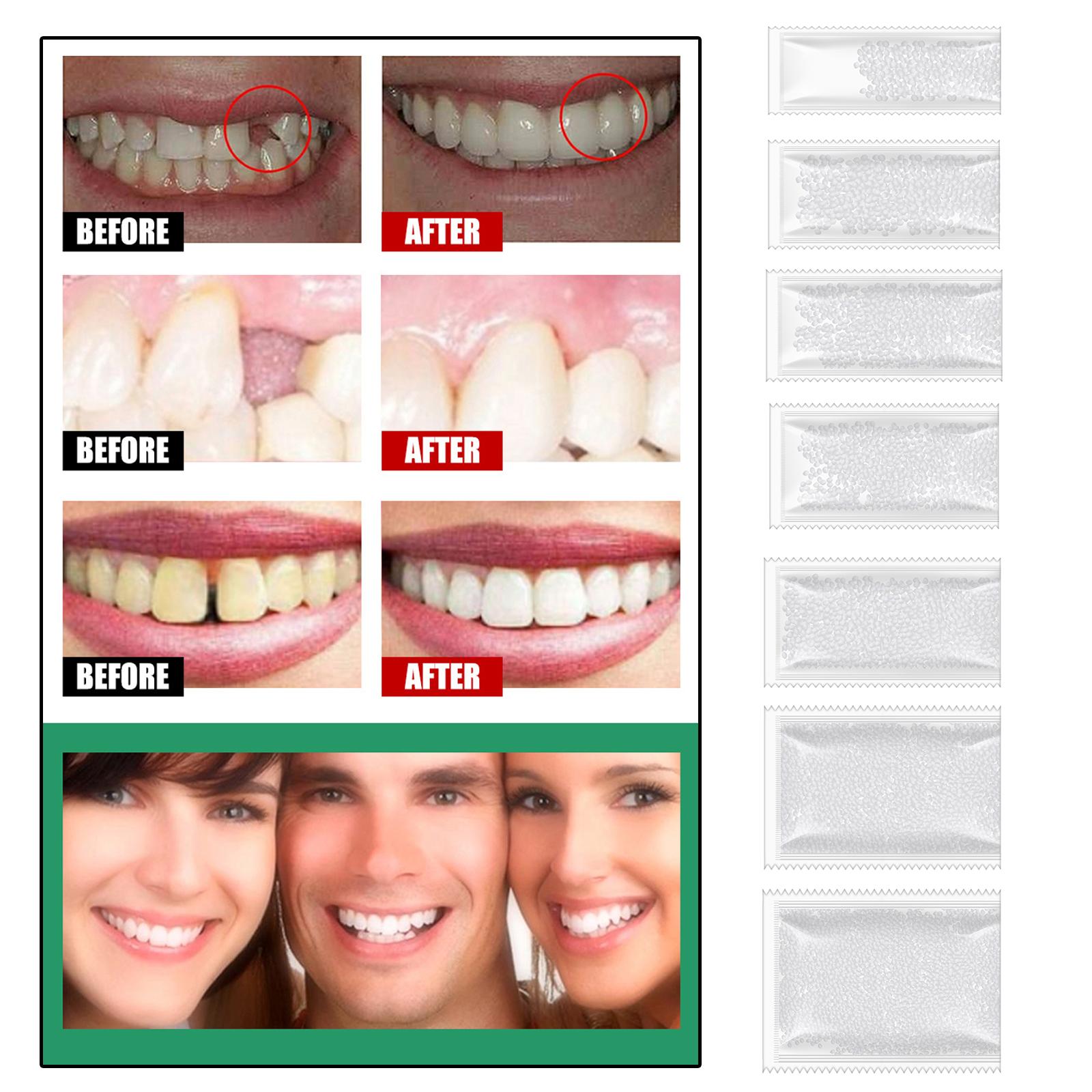 DIY Tooth Filling Thermal Beads Temporary Teeth Repair Moldable 5g