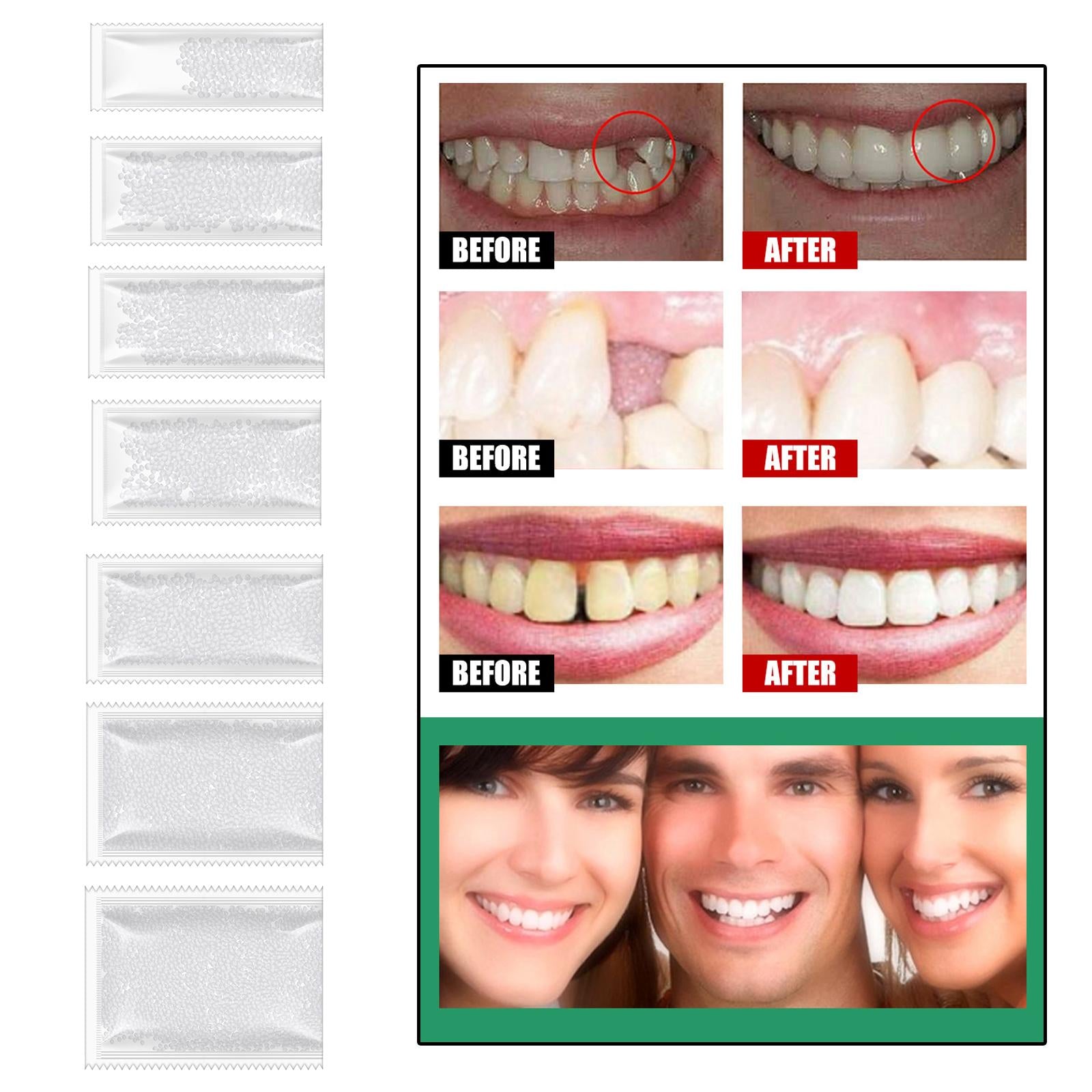 DIY Tooth Filling Thermal Beads Temporary Teeth Repair Moldable 5g