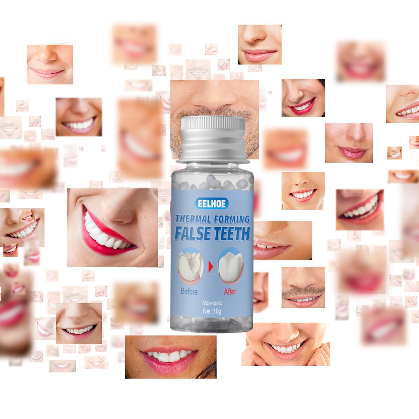 1 Bottle Thermal Fitting Beads Temporary Teeth Repair Thermal Beads 10ml