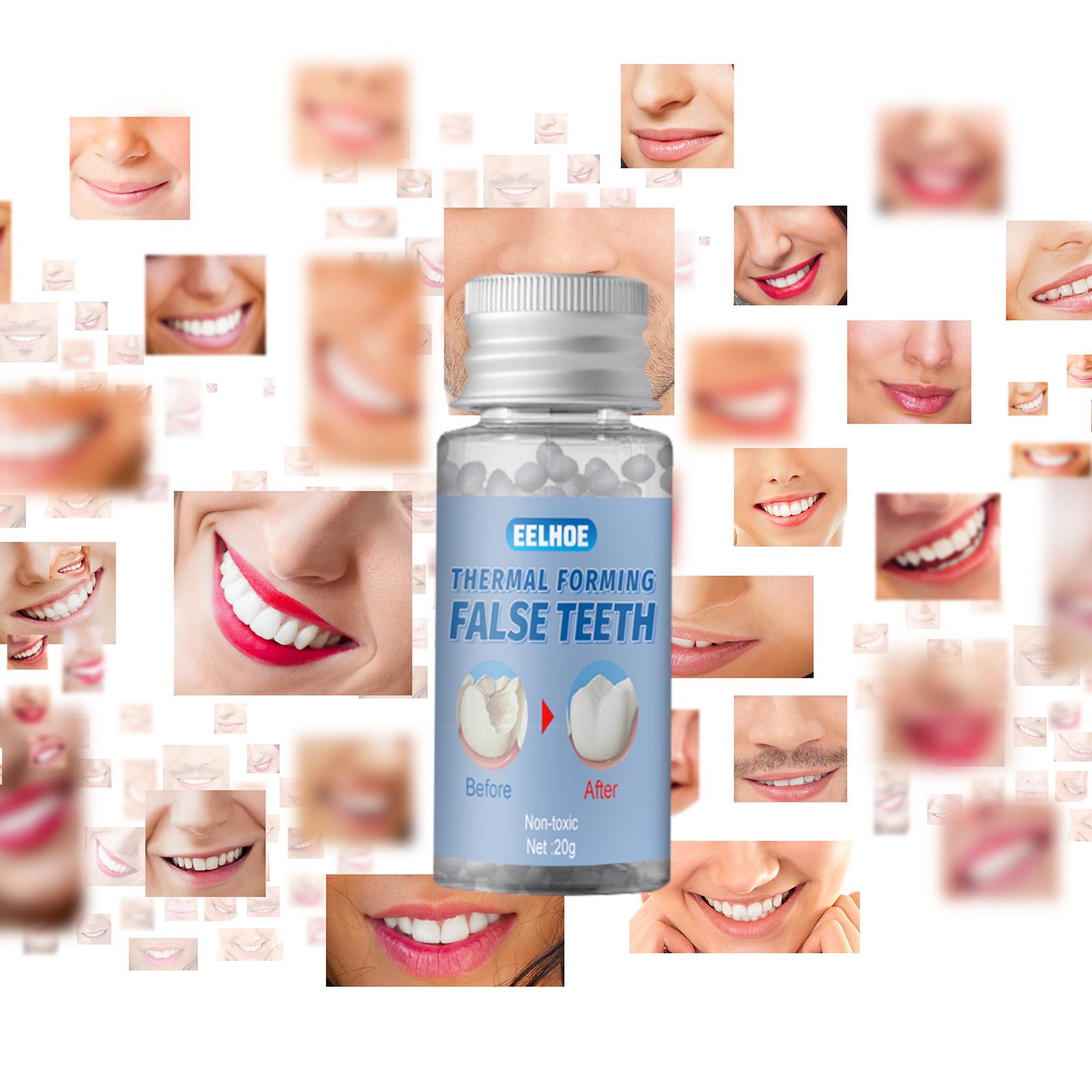 1 Bottle Thermal Fitting Beads Temporary Teeth Repair Thermal Beads 20ml