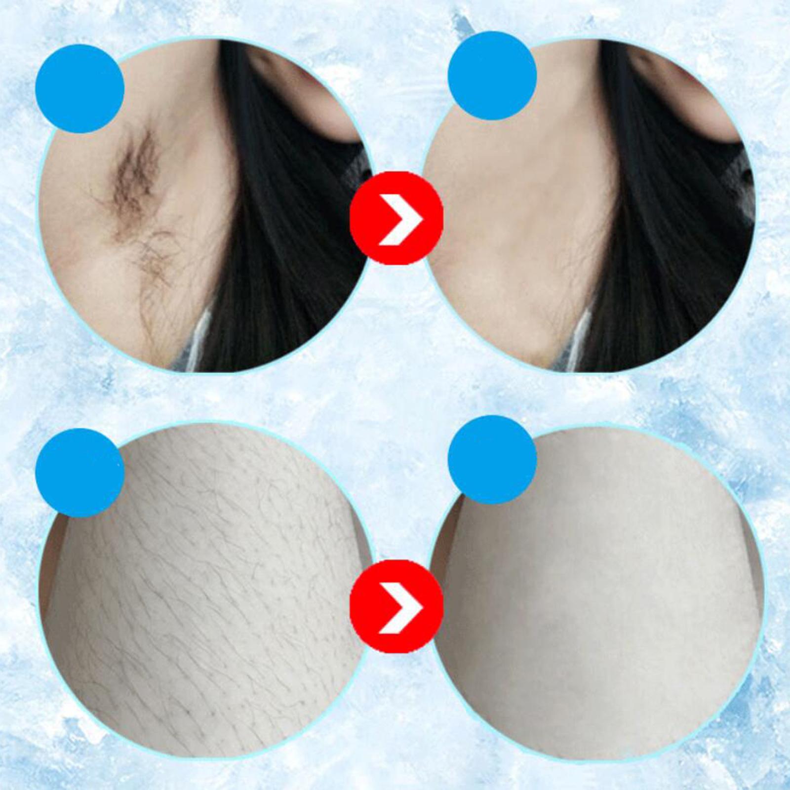 Hair Removal 2 Modes for Whole Body Face Bikini Home Use US white rose gold