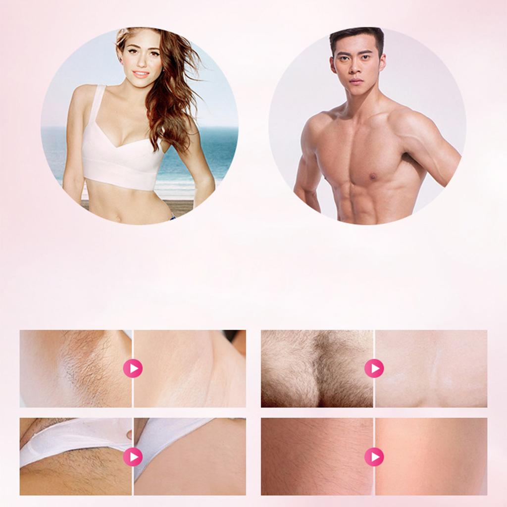 Laser Hair Removal Epilator Face Leg Permanent Hair Remover US White US