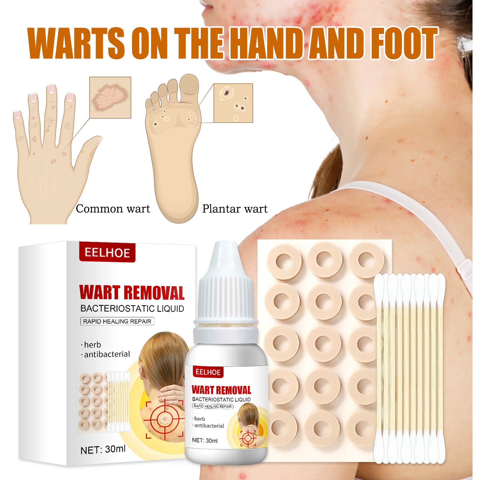 Wart Remover 30ml Wart Removal Common Warts
