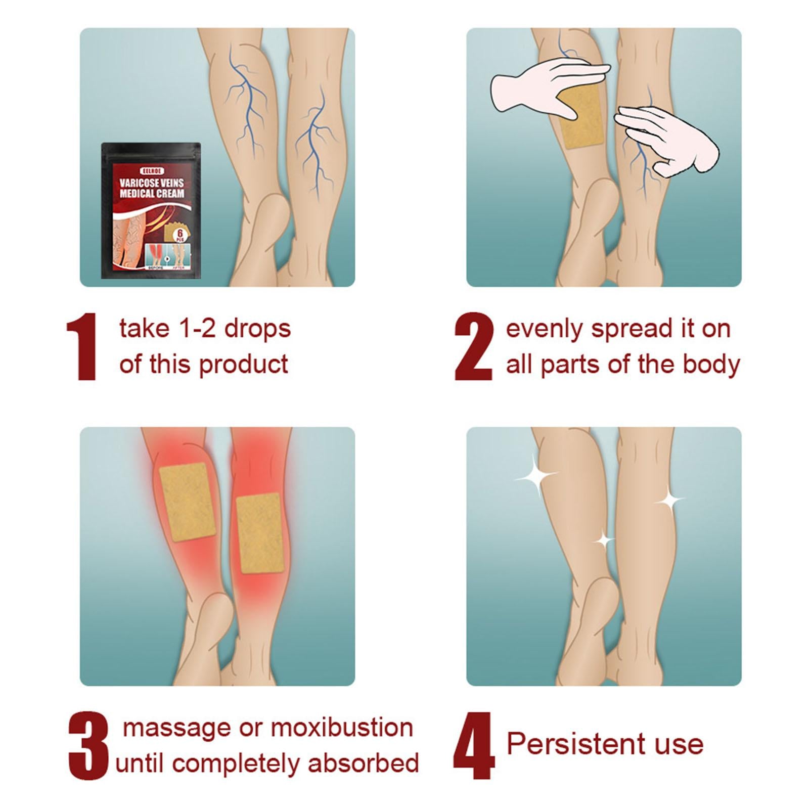 6pcs Vein massage varicose leg vein patch with optional pen without pen