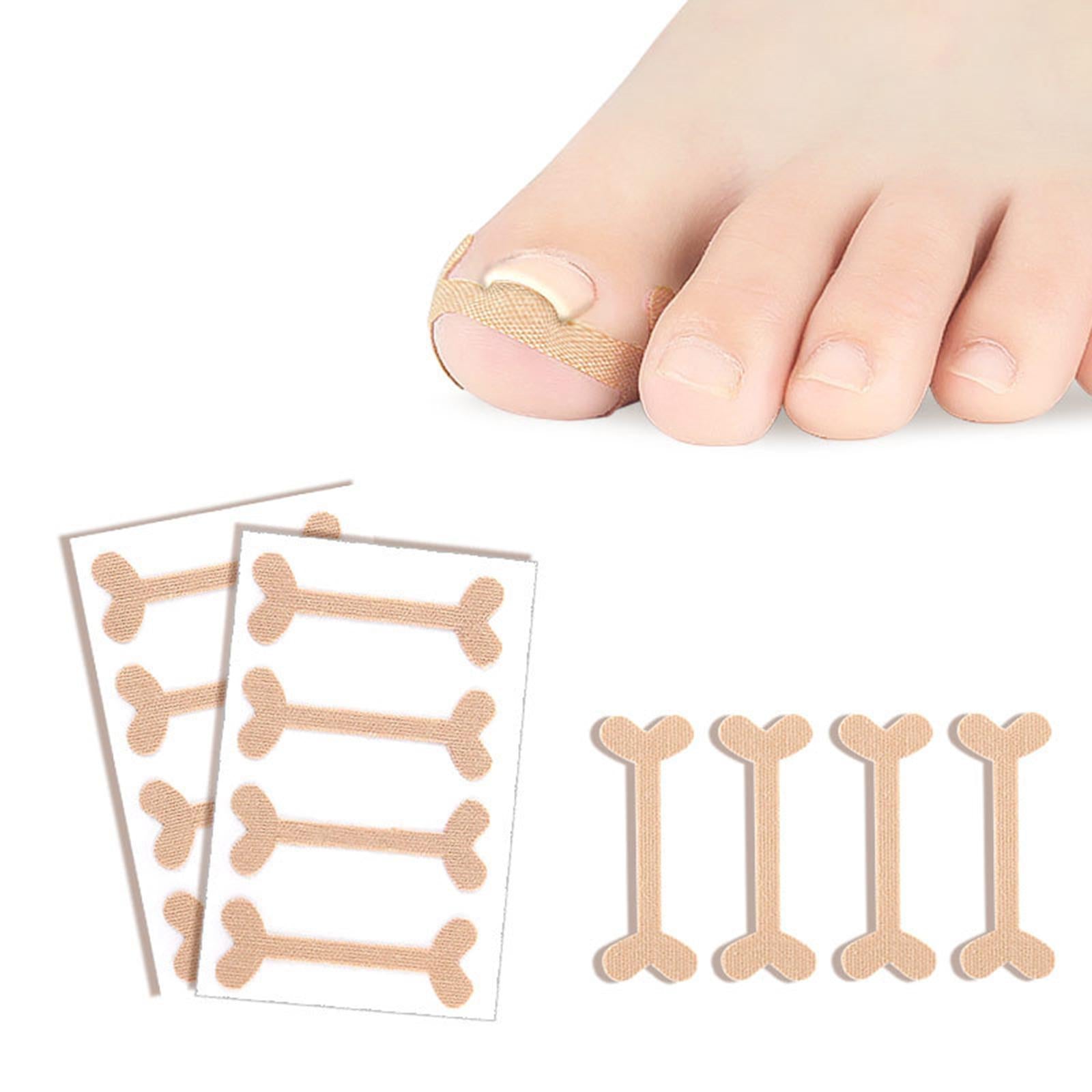 Ingrown Toenail Tool Set Stainless Steel for Cleaning Ingrown Toenails