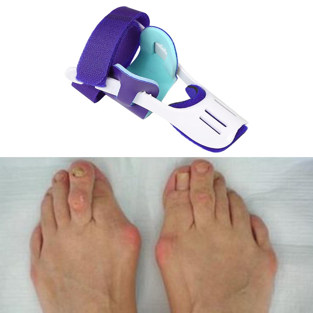 Bunion Corrector Comfort Spacers Brace for Hallux Vulgus Women and Men Right