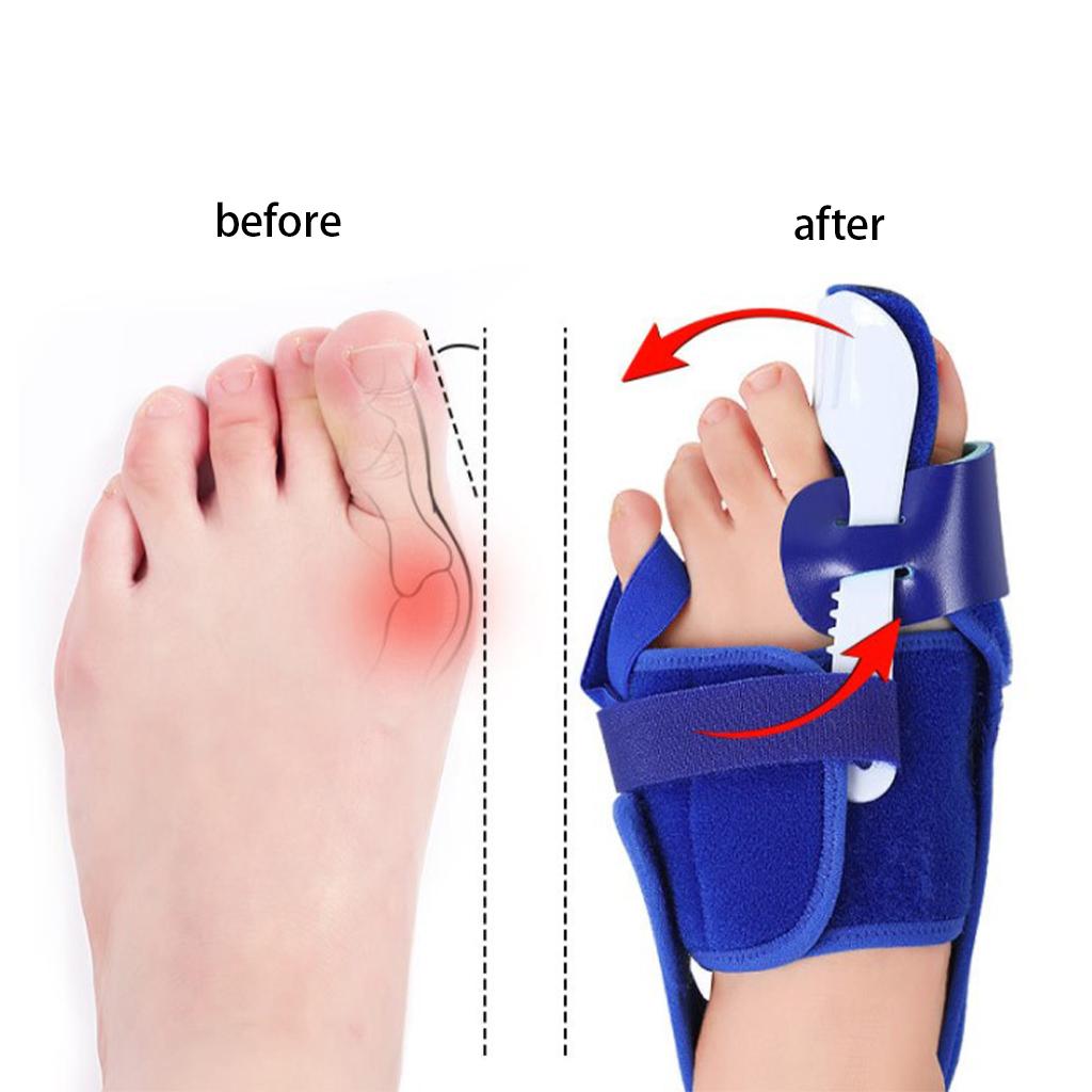 Bunion Corrector Comfort Spacers Brace for Hallux Vulgus Women and Men Right