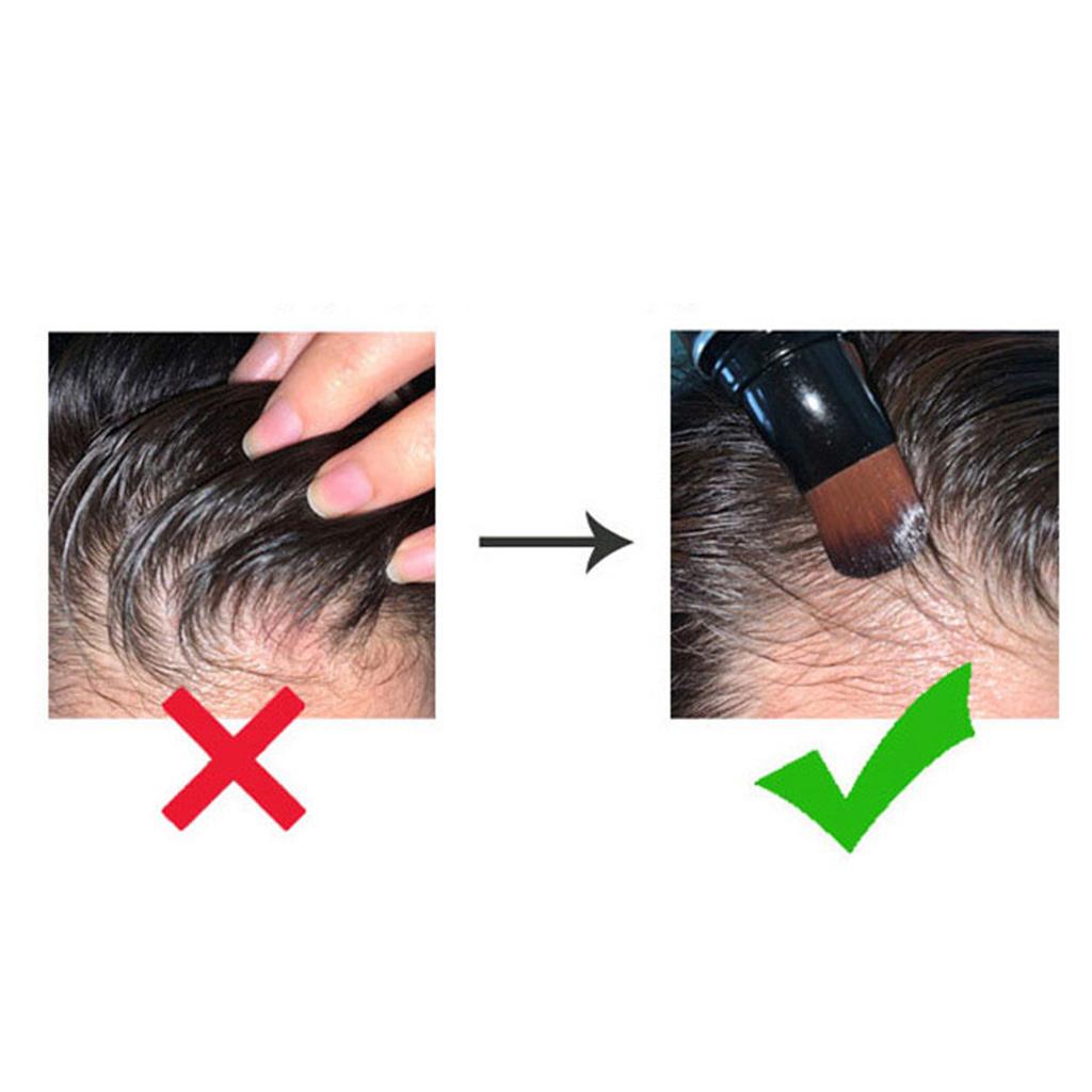 Scalp Applicator Brush 20ml Refillable Soft for Thinning Hair Men Women
