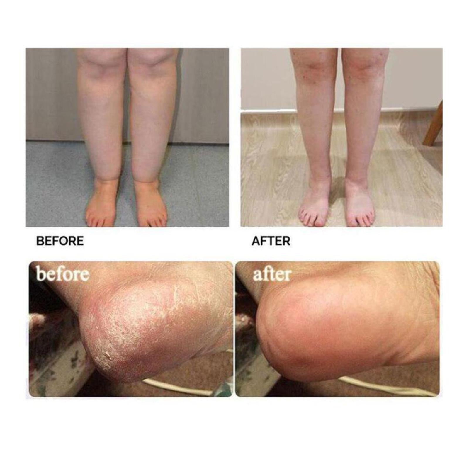 8Pcs Effervescent Balls Anti-Mildew Foot SPA for Foot Pain Foot Bath Men