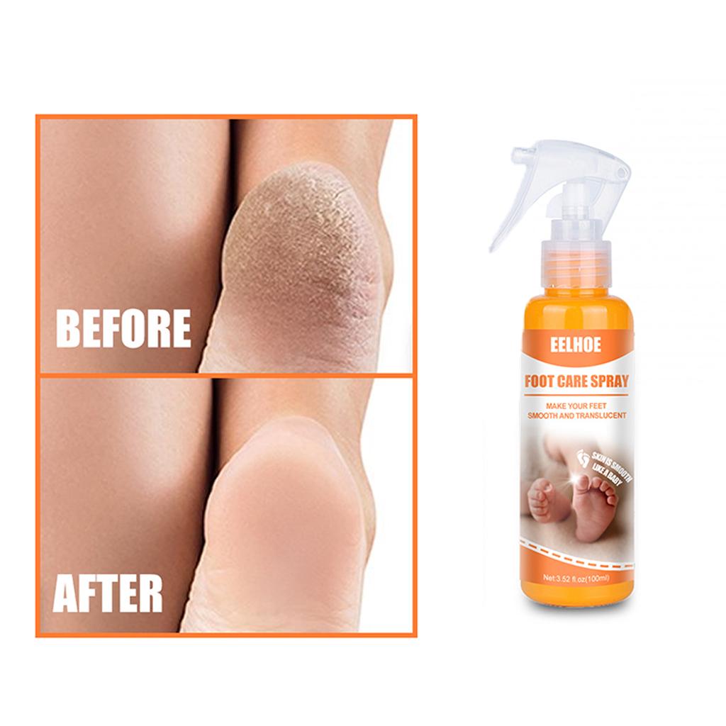 Foot Peeling Spray Feet Hard Skin Remover Hydrating Moisturzing 100ml