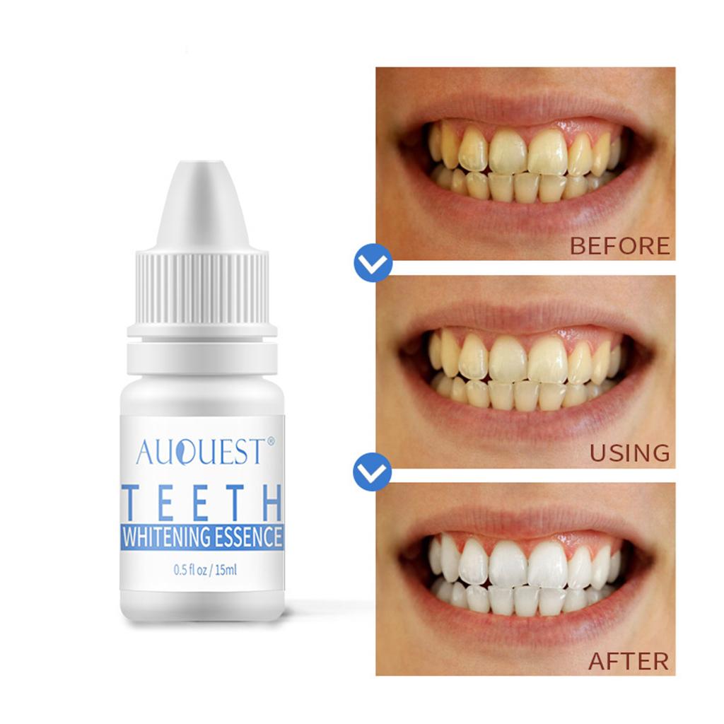 Teeth Whitening Essence Safe for Teeth Stains Removing Tea Stains Home Use
