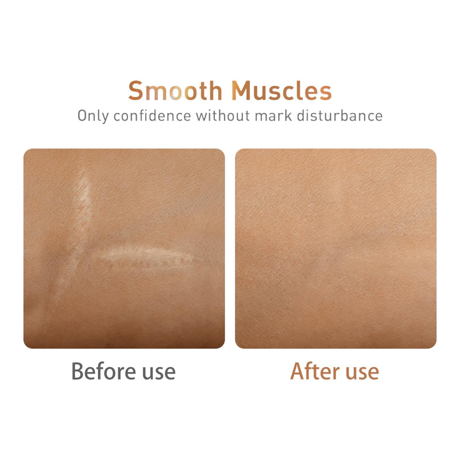 Reduces Marks Scar Serum Moisturized Youthful Skin Scars Marks Skin Care