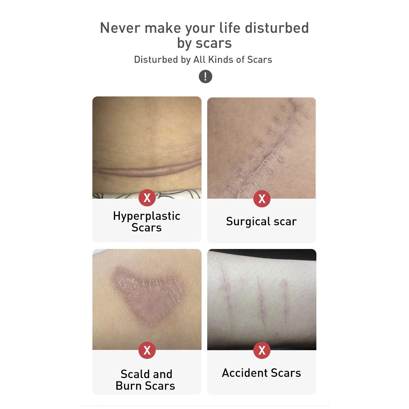 Reduces Marks Scar Serum Moisturized Youthful Skin Scars Marks Skin Care