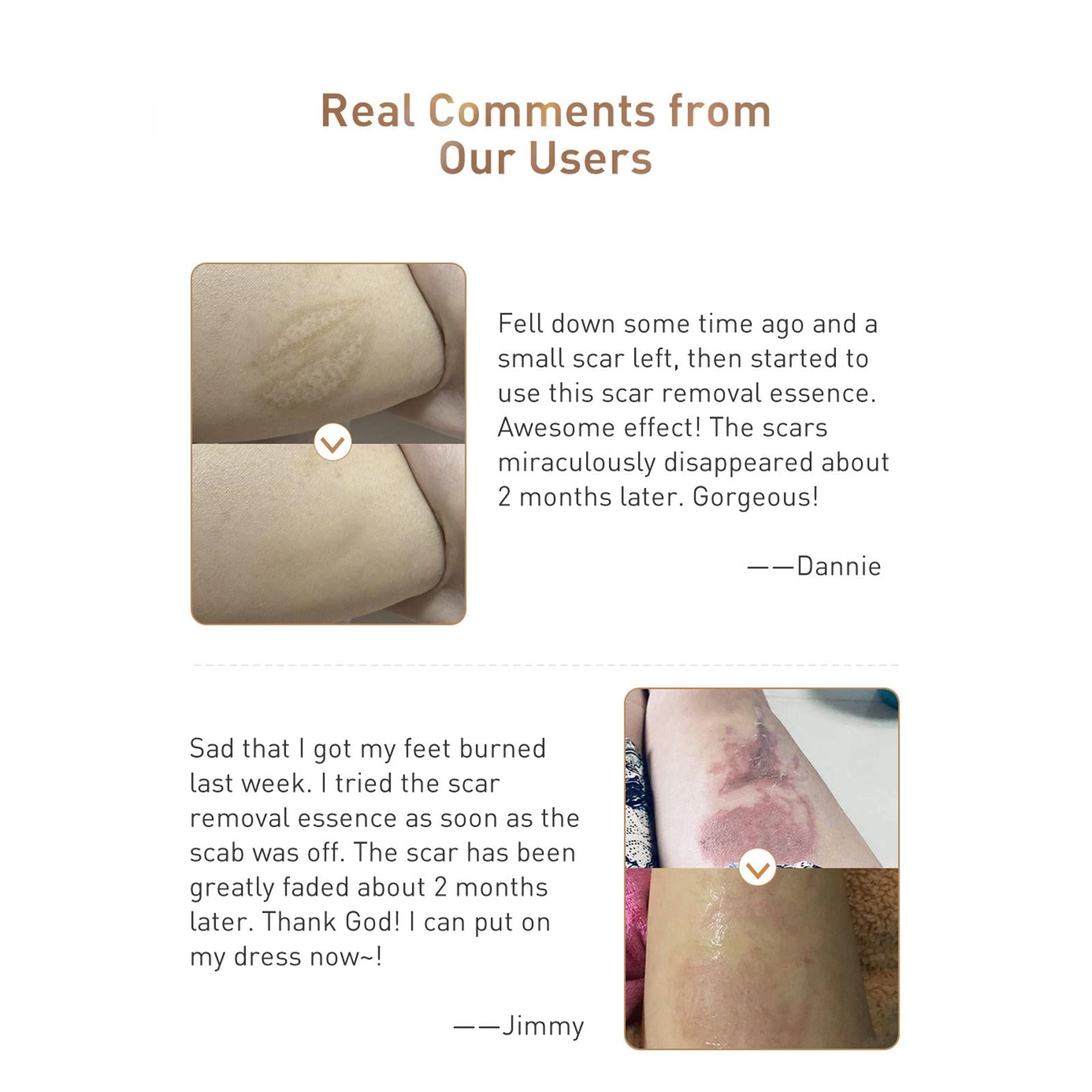Reduces Marks Scar Serum Moisturized Youthful Skin Scars Marks Skin Care