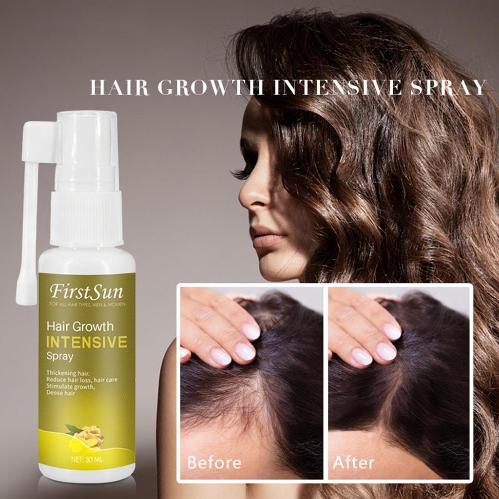 30ml Hair Growth Intensive Spray Hair Care Reducen Hair Loss Women Men