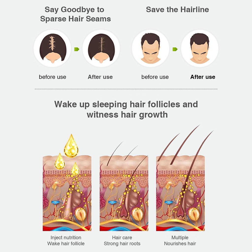 30ml Hair Growth Intensive Spray Hair Care Reducen Hair Loss Women Men