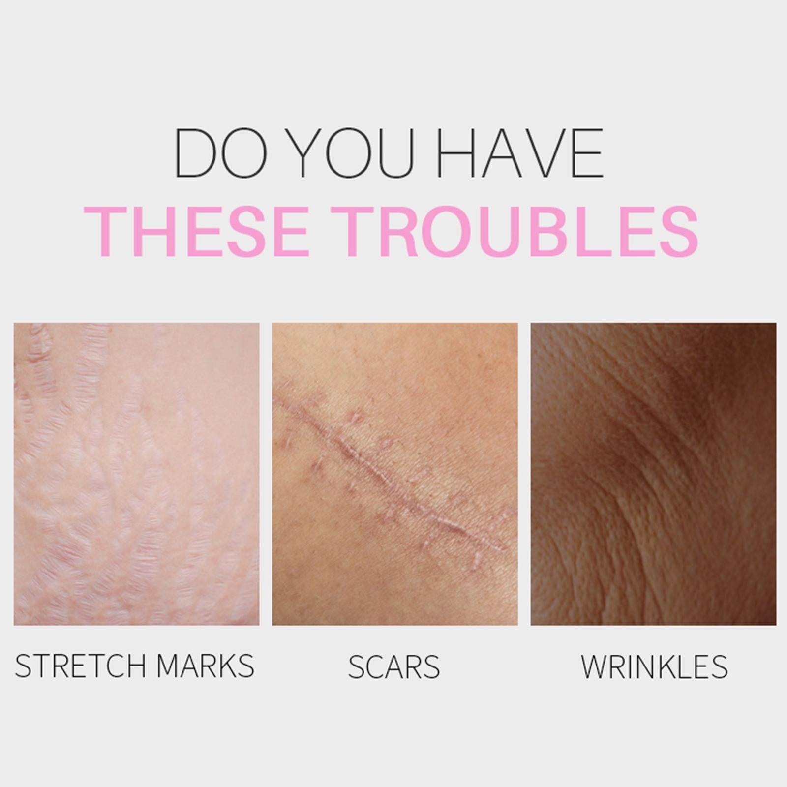 10G Pure Rosehip Oil Reduce Scars Wrinkles Hydrating Organic Anti Aging