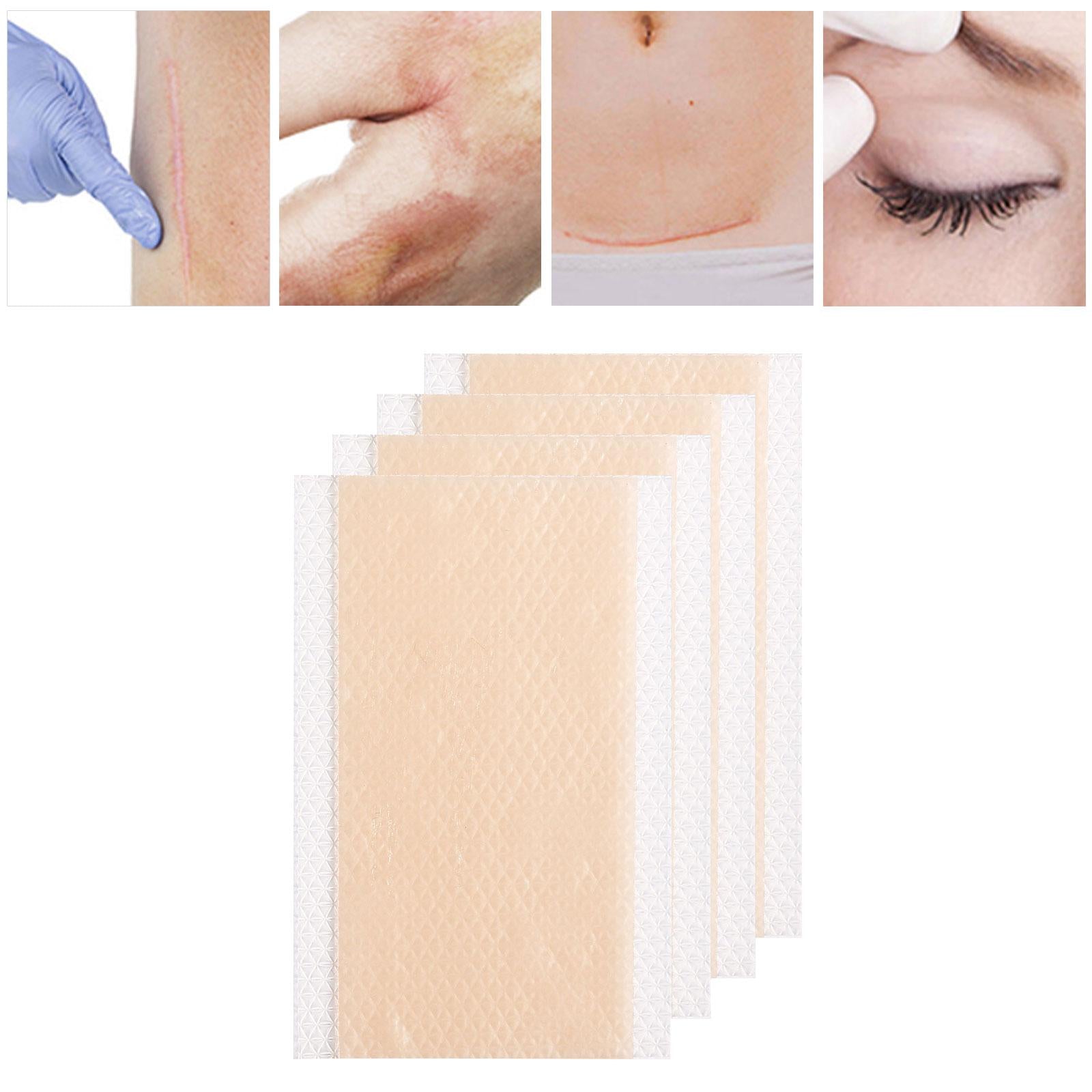 Silicone Scar Stickers Self-Adhesive Soft Silicone Sheets for Scars Women